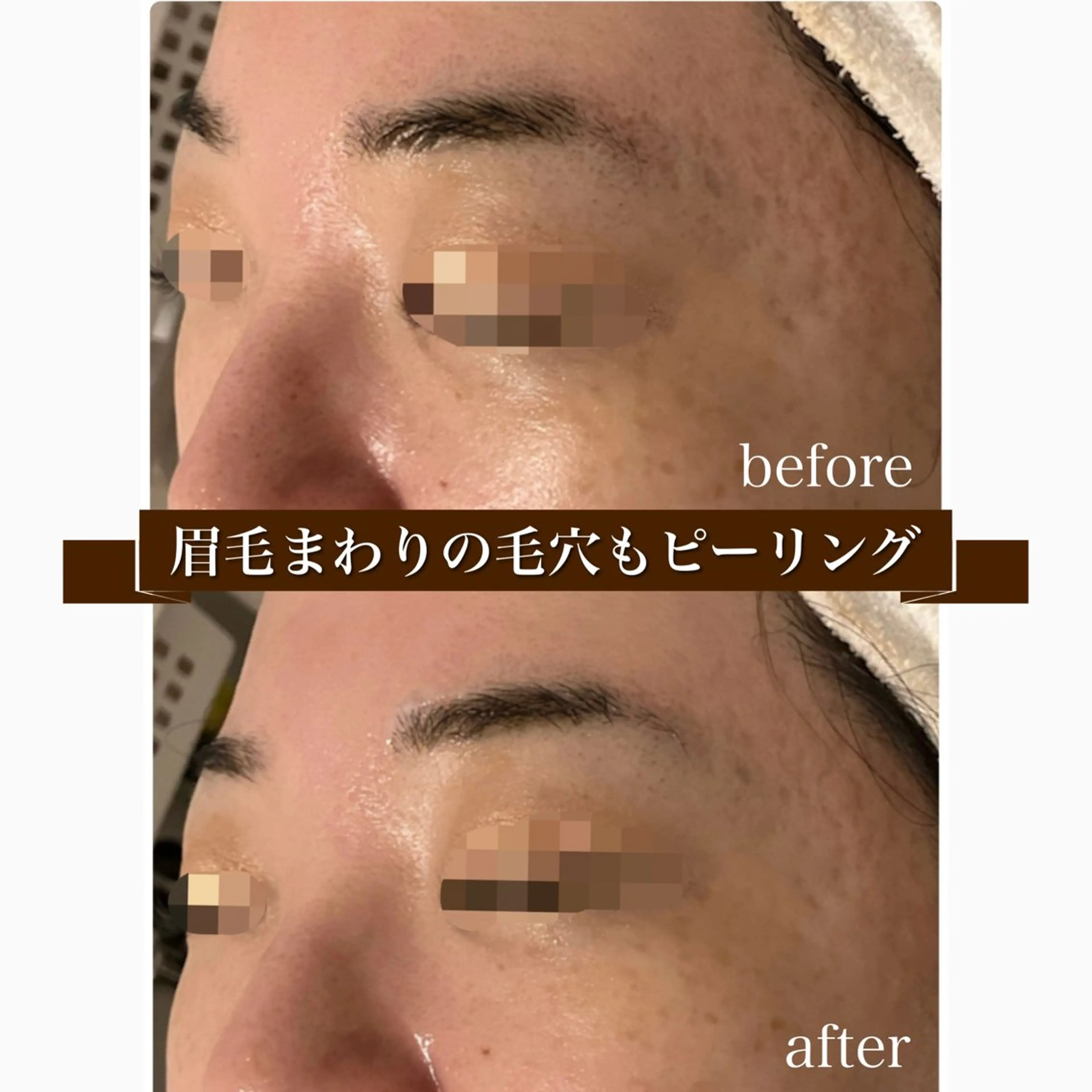 Lily branc 痩身/小顔/肌質改善のエステ・リラクイメージ