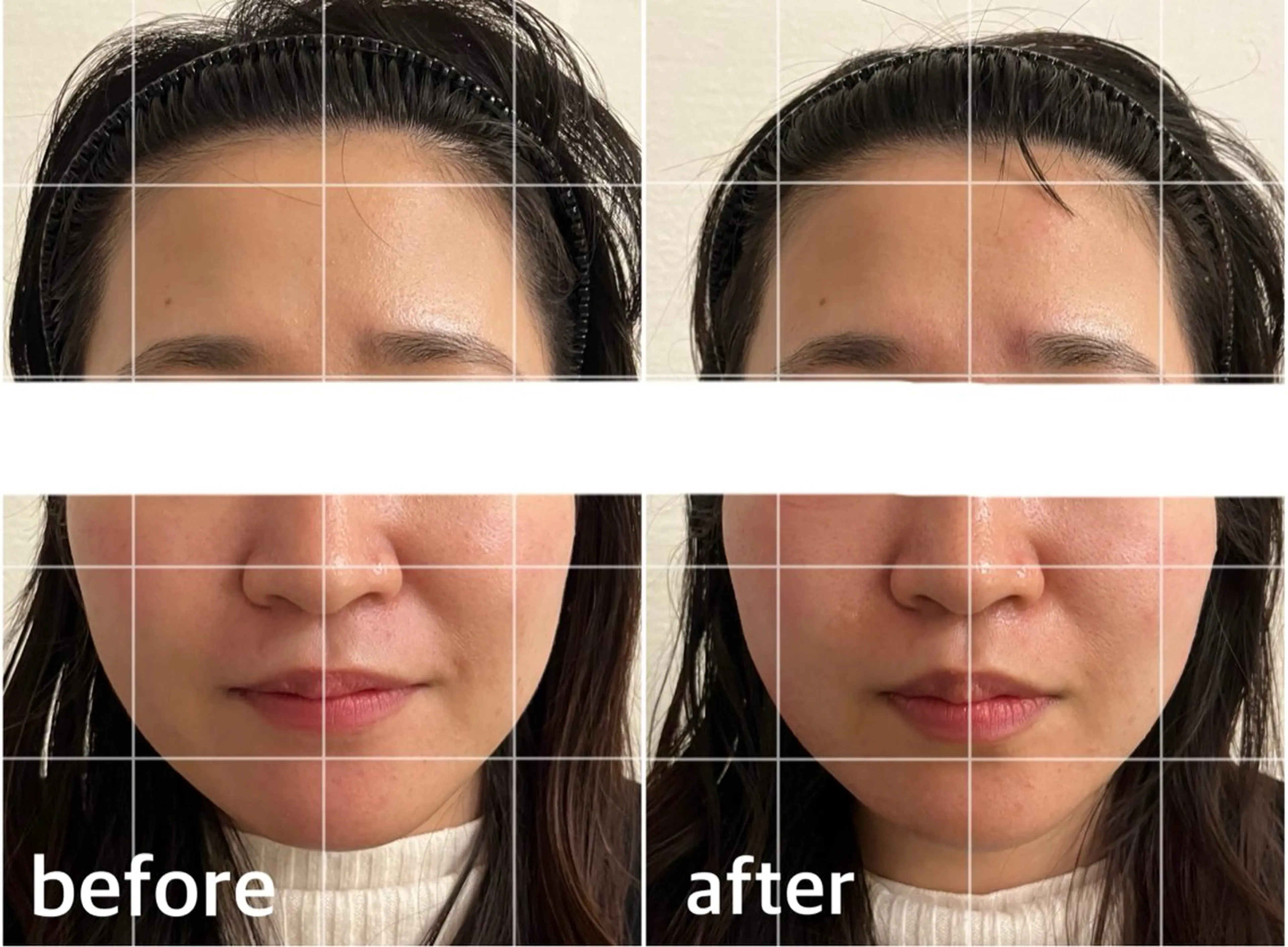 bellissimo 【ベリッシモ】所属・ちひろ　痩身/ハーブ bellissimoのエステ・リラクイメージ