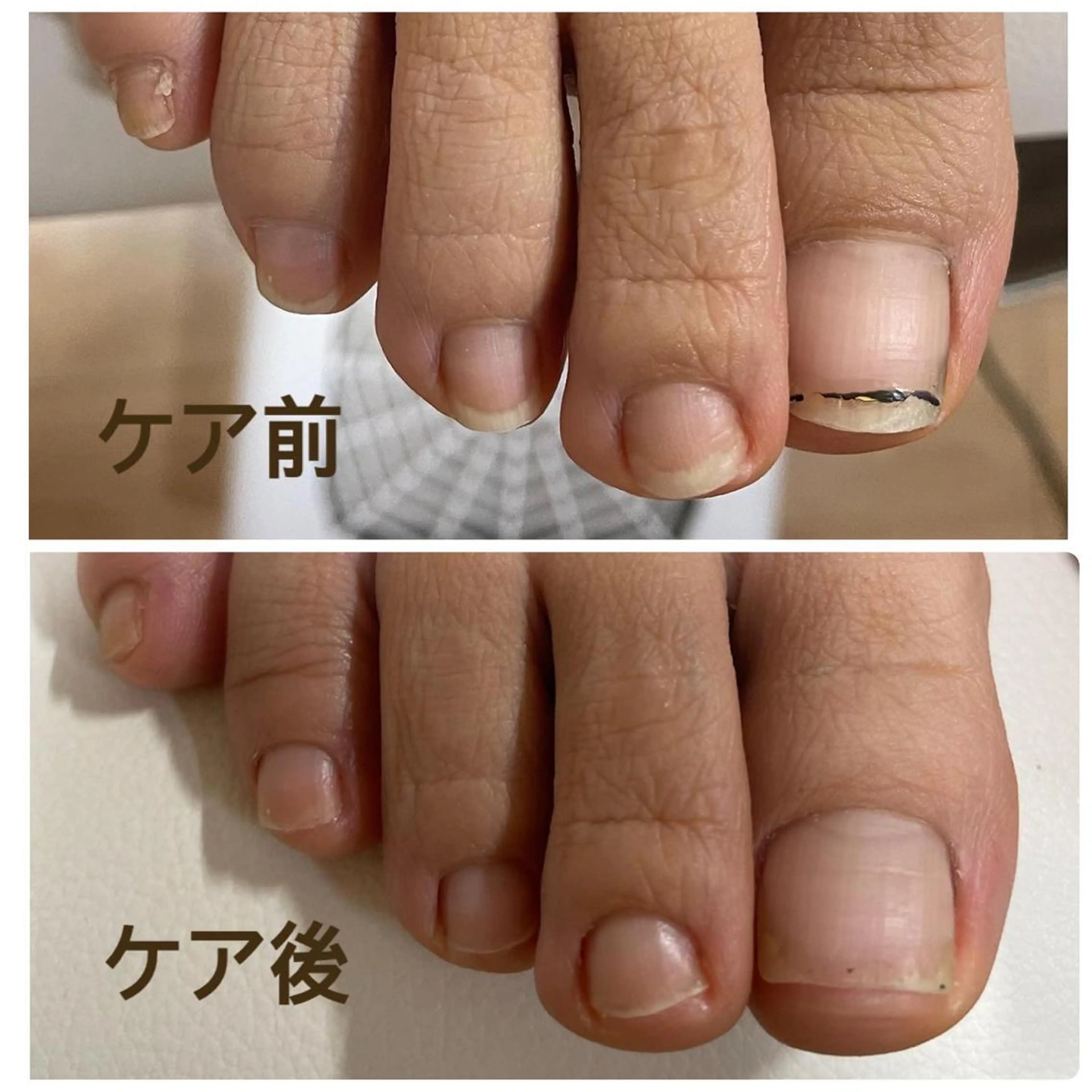 ネイル フットネイル 奥園 良恵のネイルデザイン