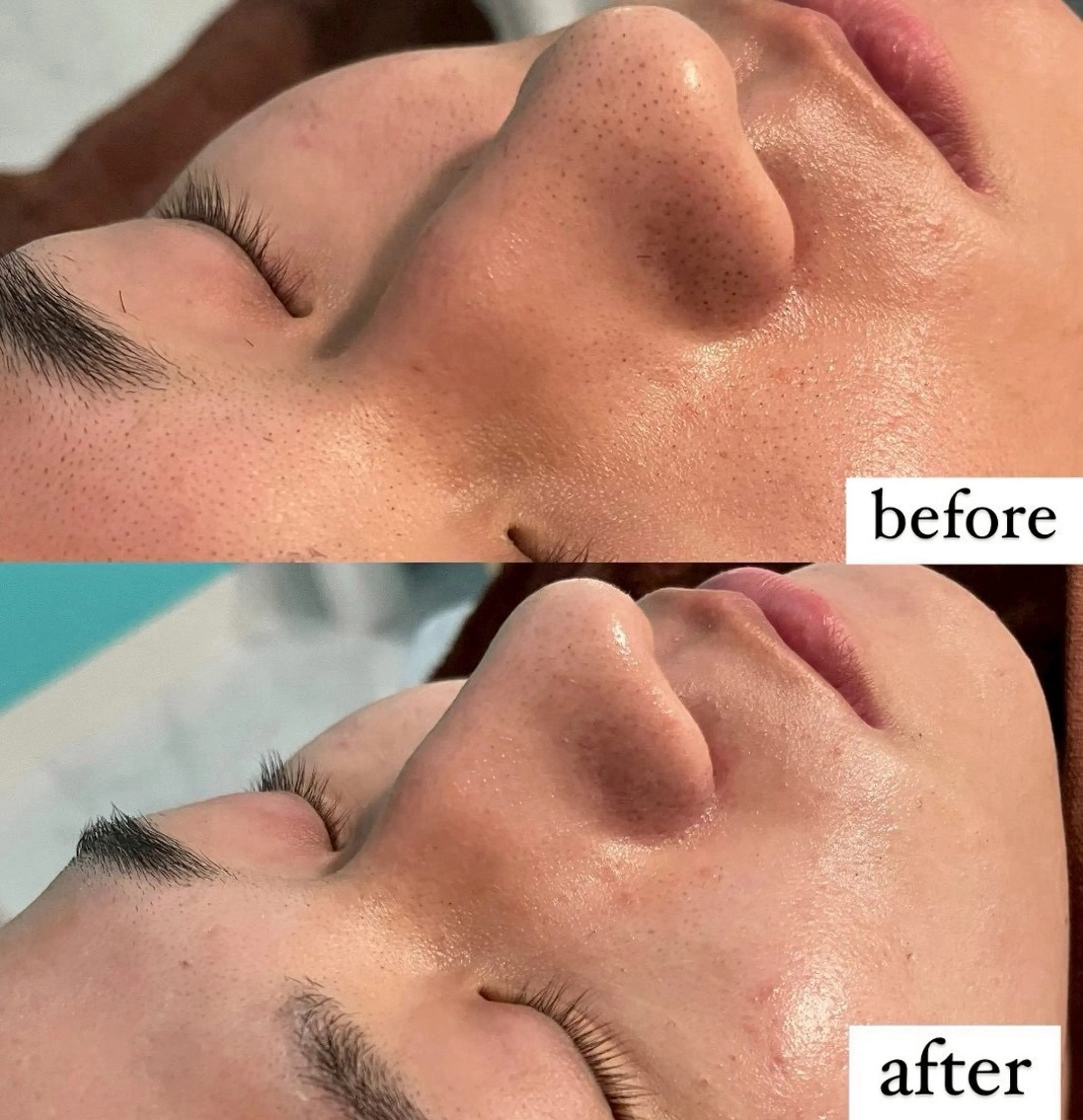 Belleつくば店所属・鈴木 華咲のエステ・リラクイメージ