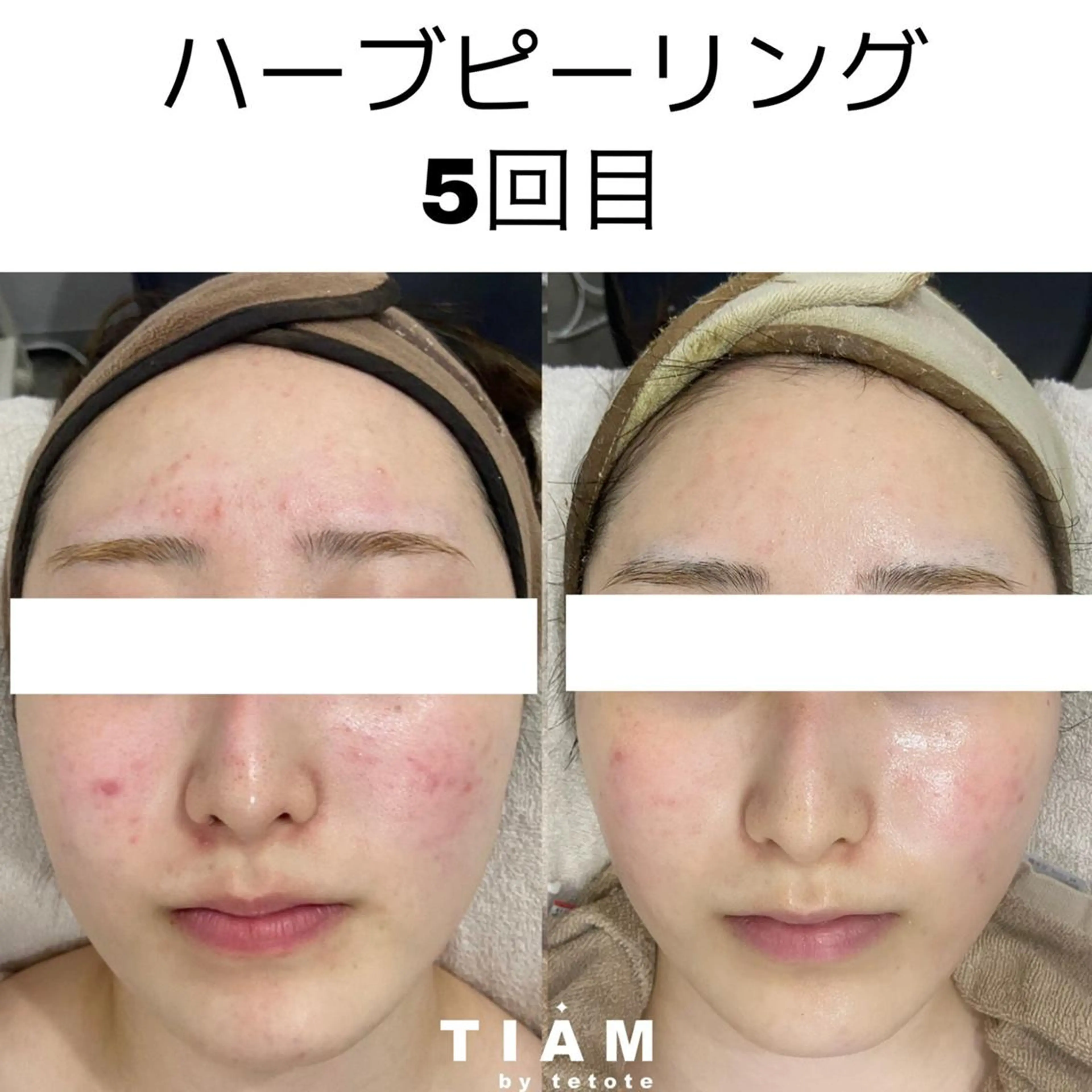 エステ 美肌サロンTIAM by tetoteのエステ・リラクイメージ