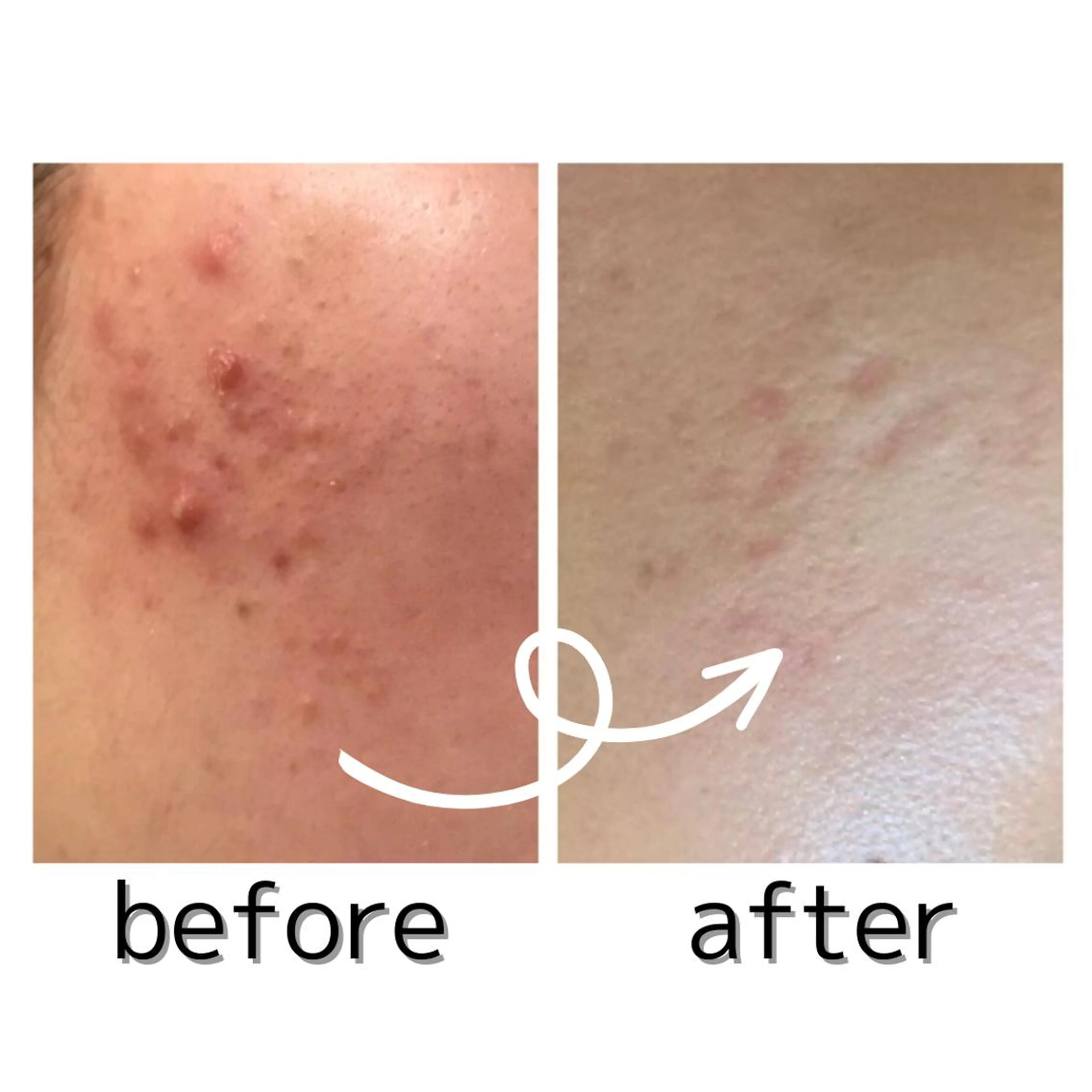 エステ aimee　肌質改善サロン【アイミー】所属・肌質改善サロン aimee｜アイミーのエステ・リラクイメージ