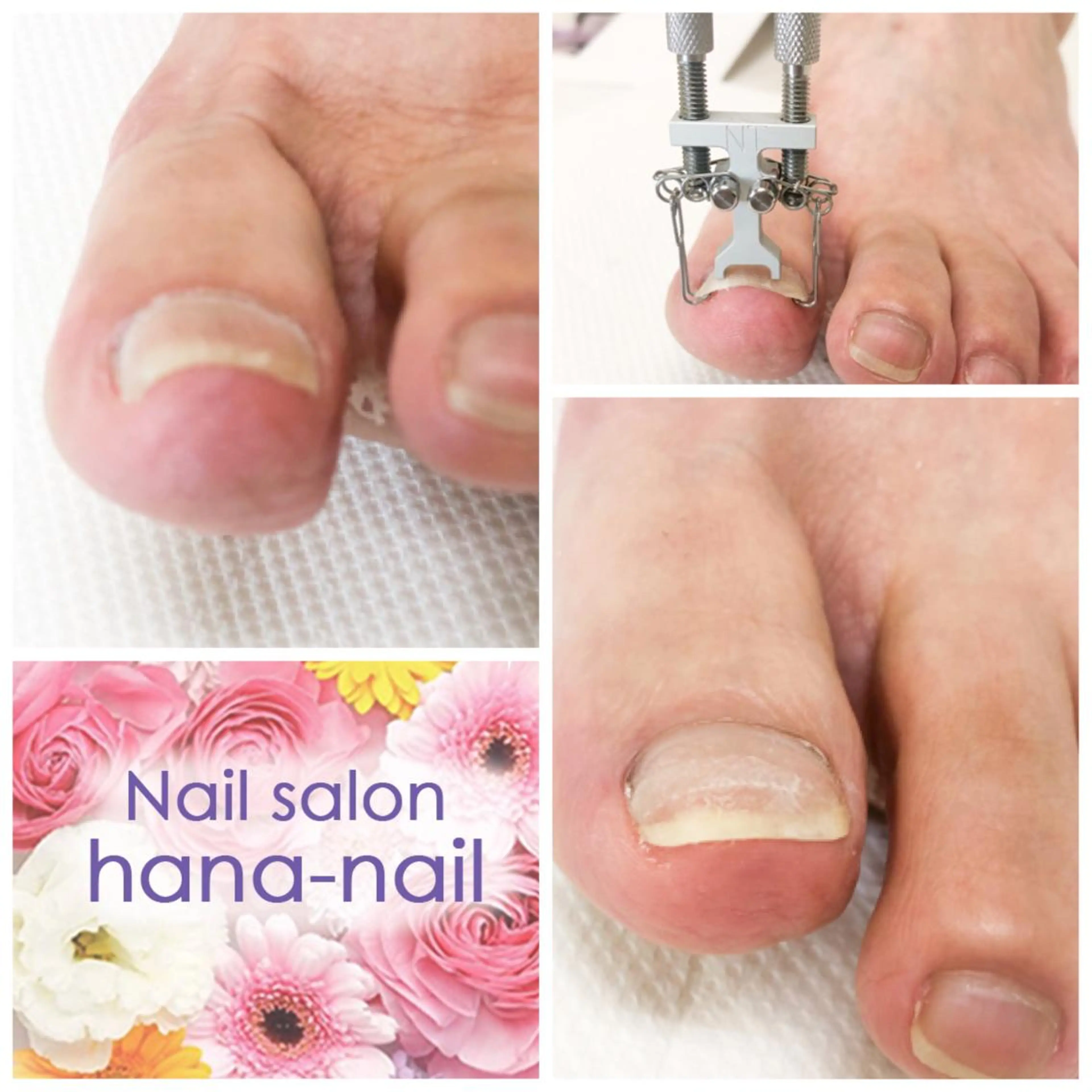 ネイル Kao hana-nailのネイルデザイン