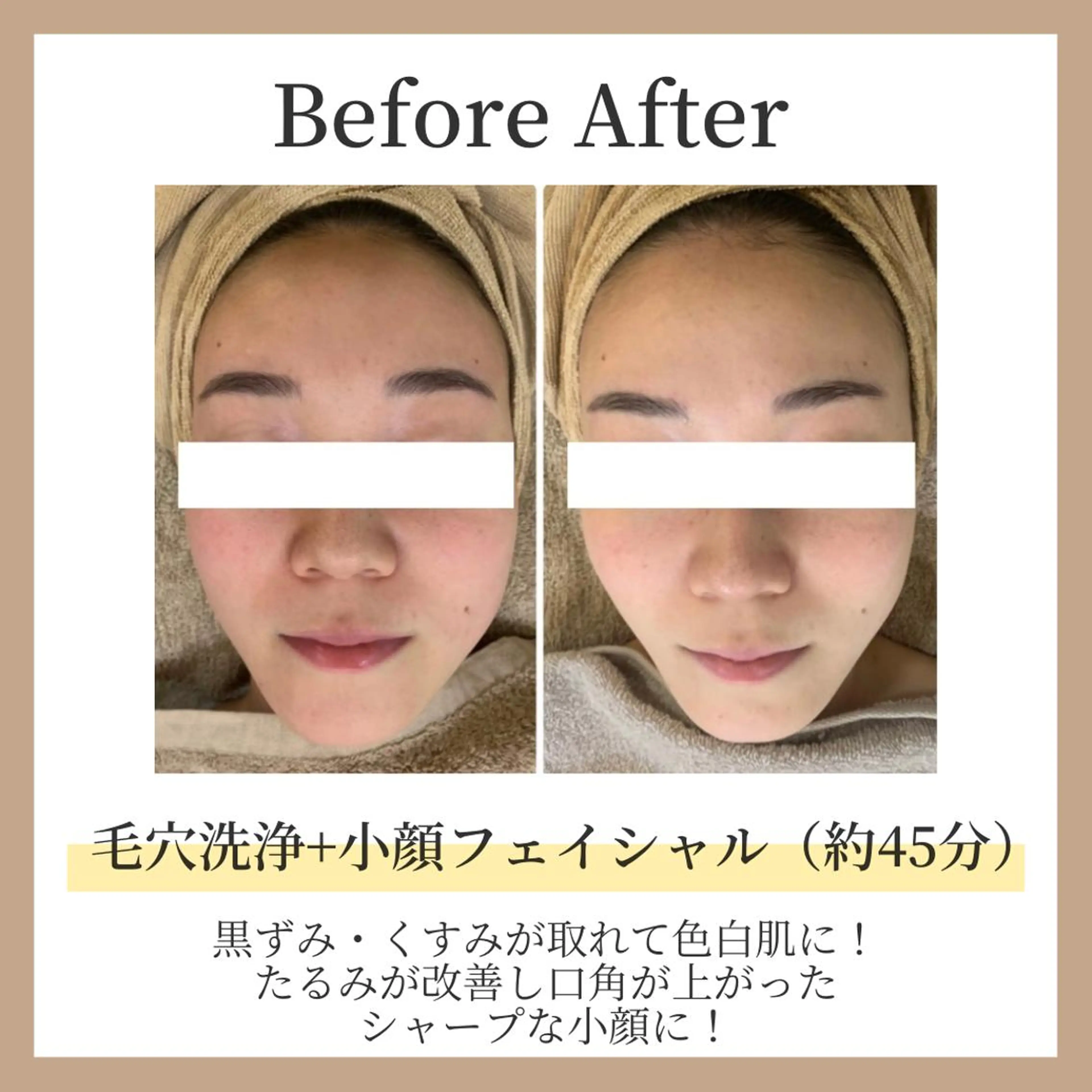 【当店1番人気!!】艶肌3D毛穴洗浄☆＋艶肌小顔フェイシャル（両頬）約45分の写真