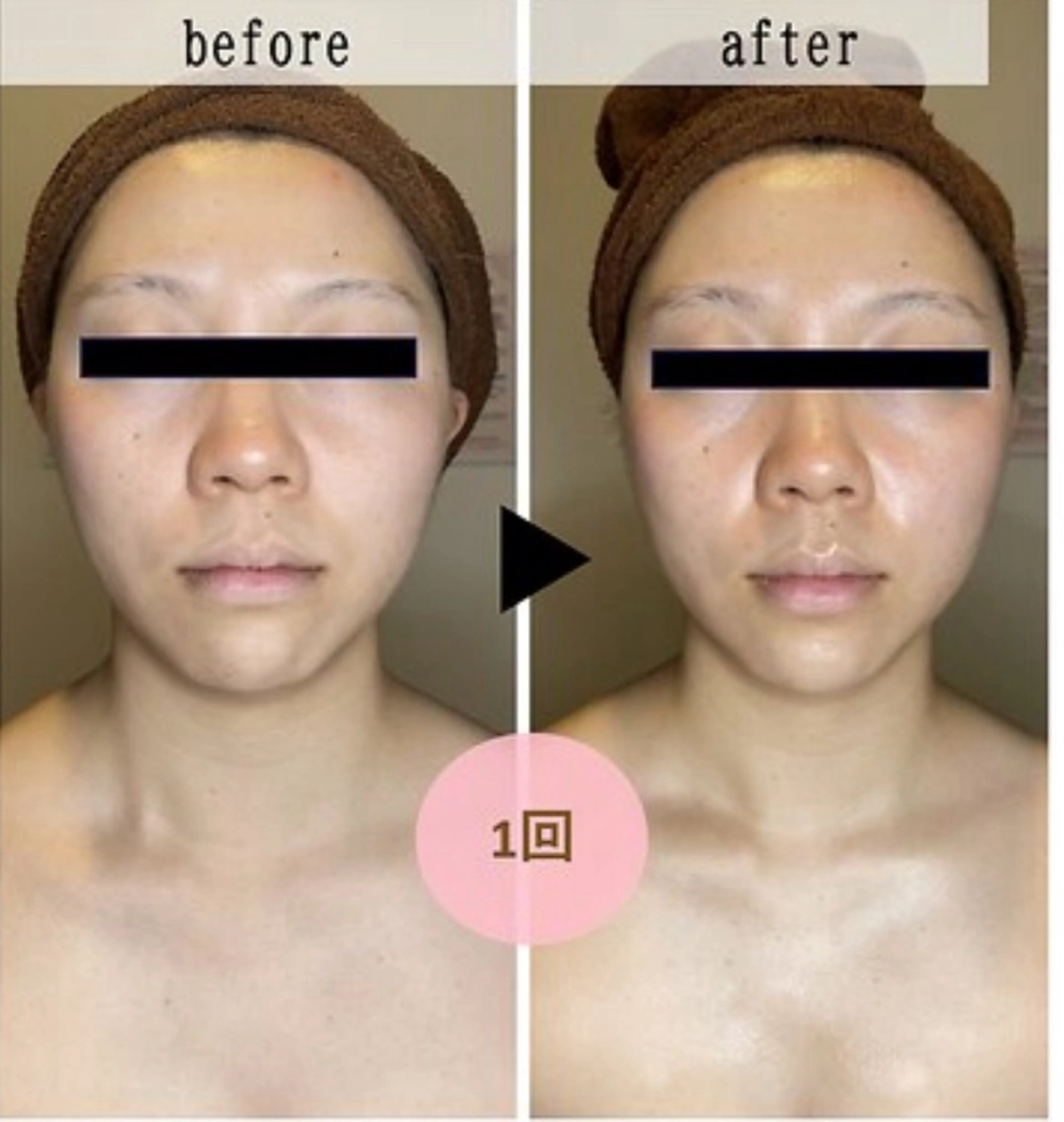 【首肩のこりがお悩みの方💆‍♀️🫧】ラジオ派とハンドマッサージで引き上げ（アロマ付🌿）の写真