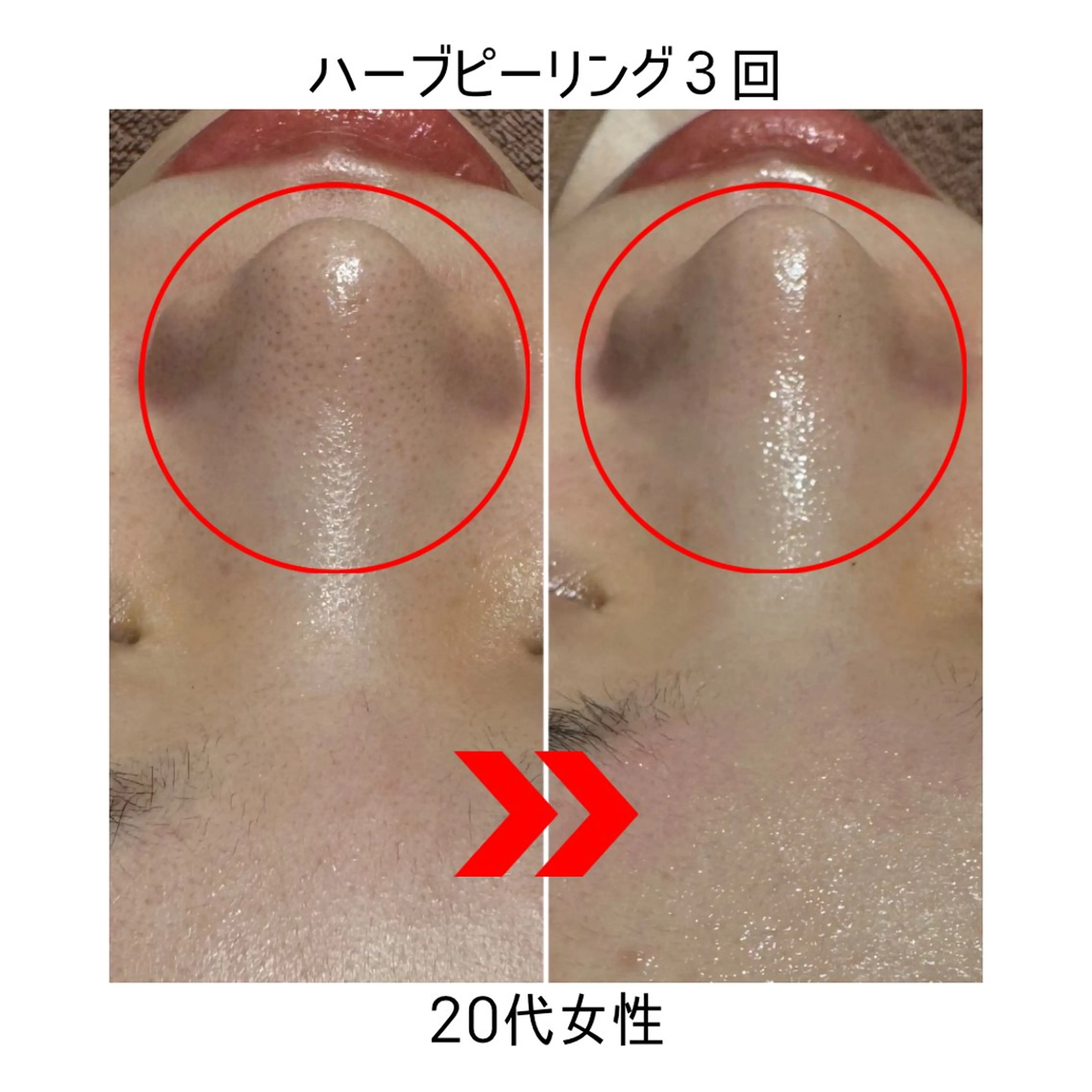 R-four🦋 土屋のエステ・リラクイメージ