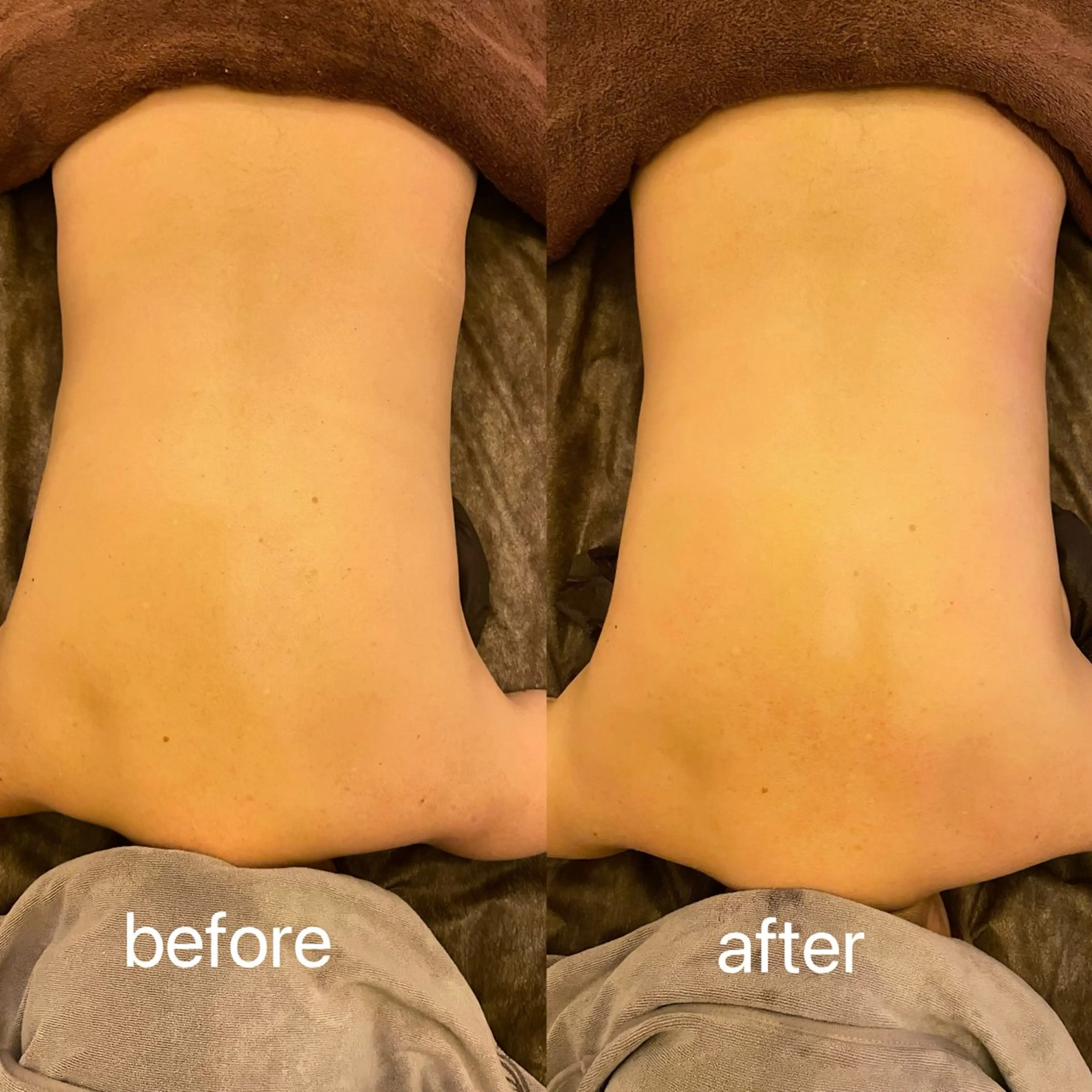 小顔＆まつ毛サロン AKANE❤️のエステ・リラクイメージ