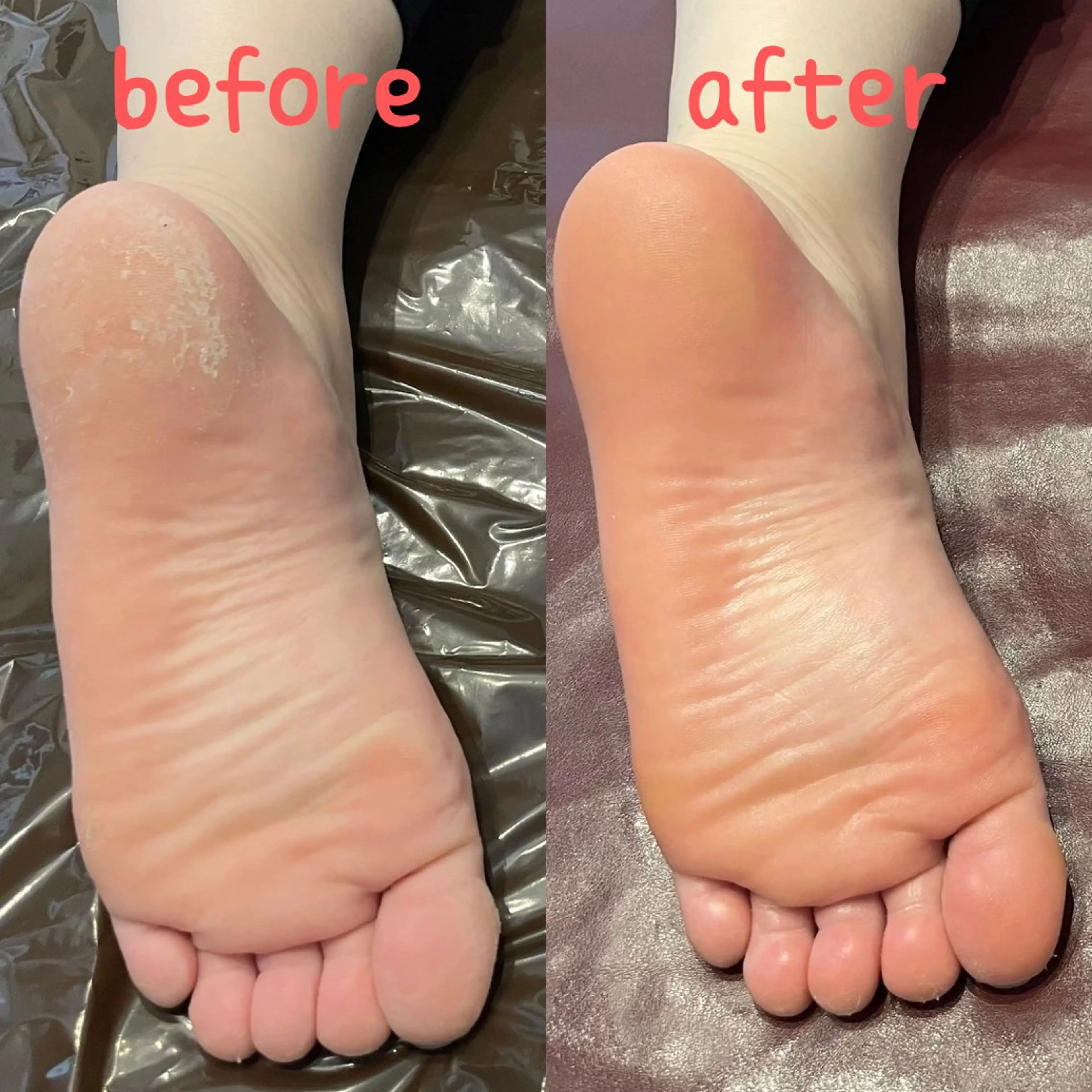 AiryBody エアリーボディけいのエステ・リラクイメージ