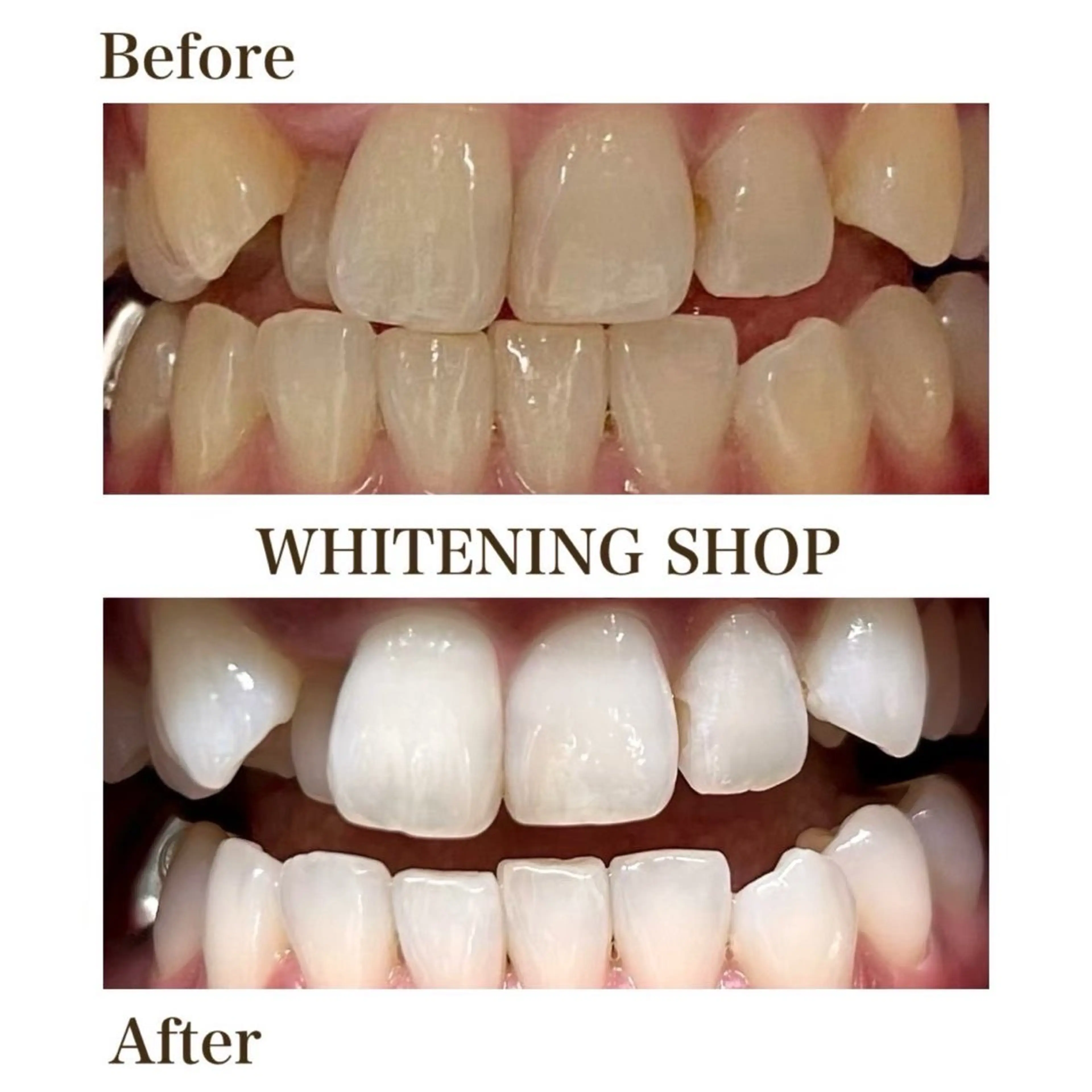 その他 ホワイトニングショップ津店所属・ホワイトニング ショップ津店のその他イメージ