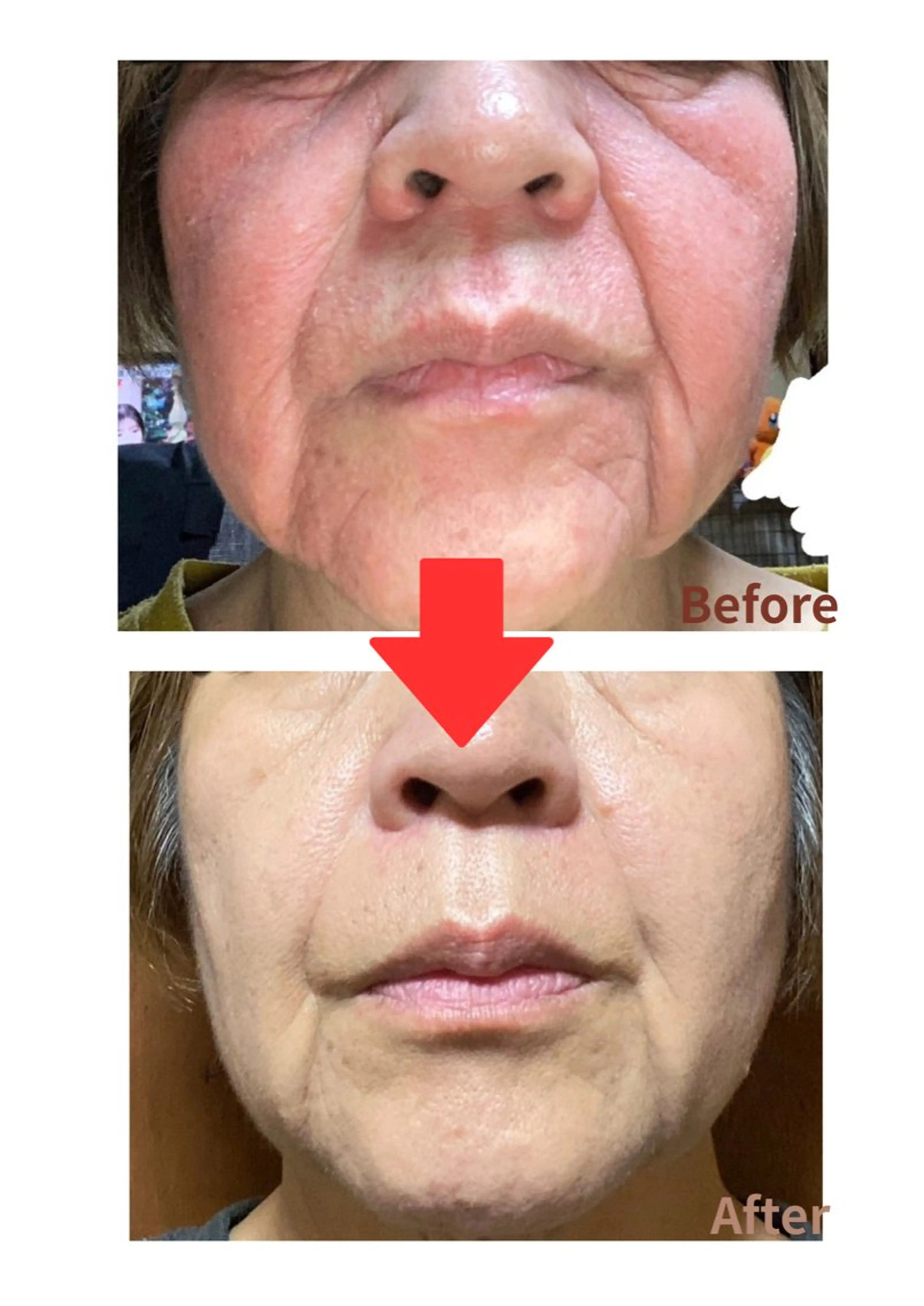 Belle White所属・本格痩身＊肌質改善＊ BelleWhiteのエステ・リラクイメージ