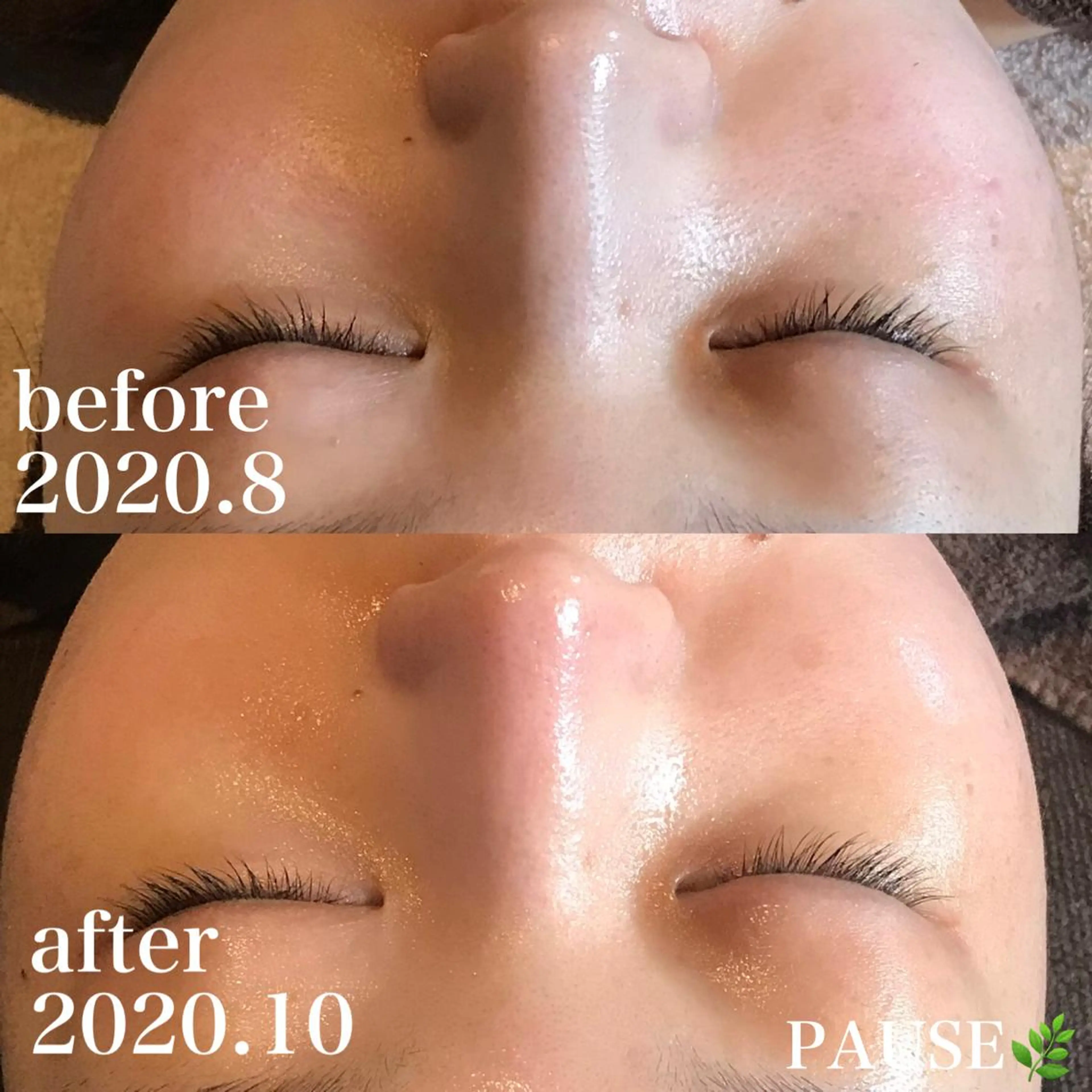 エステ 浜野 恵美のエステ・リラクイメージ