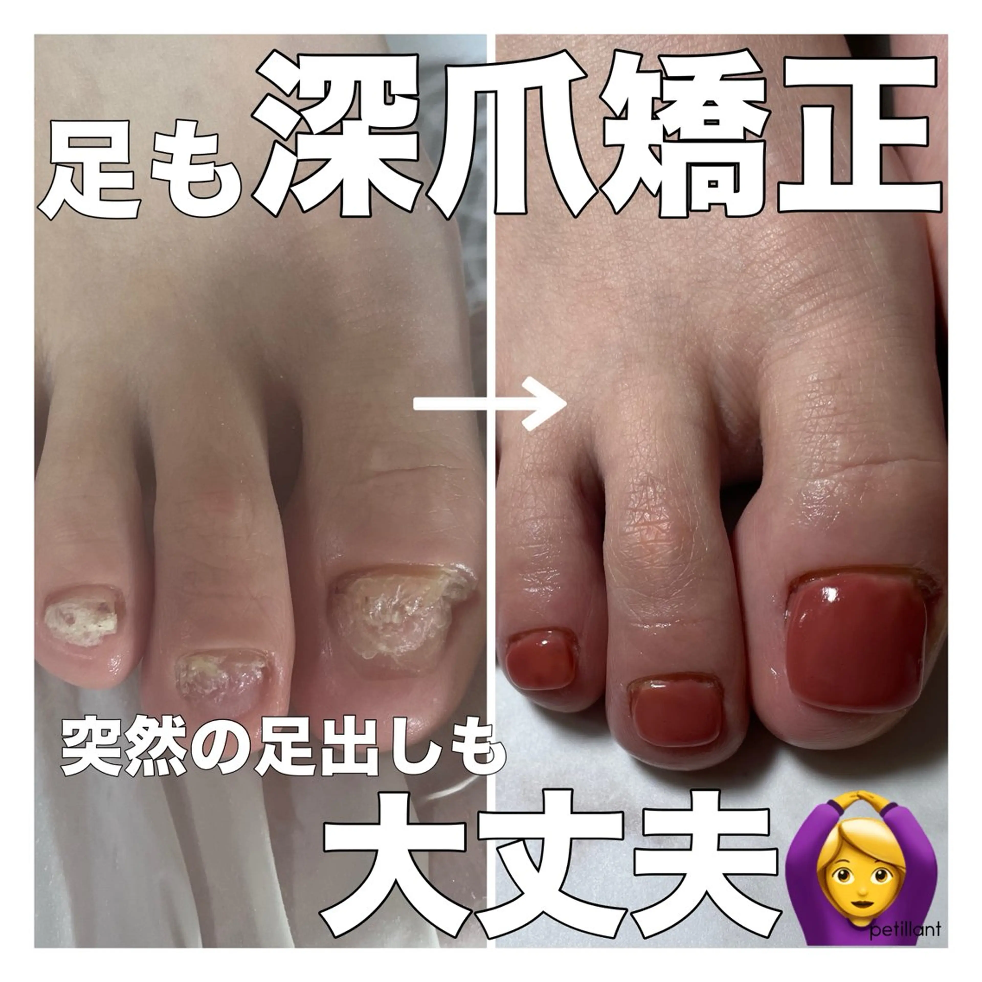 ネイル 春ネイル petillant所属・nail salon petillantのネイルデザイン