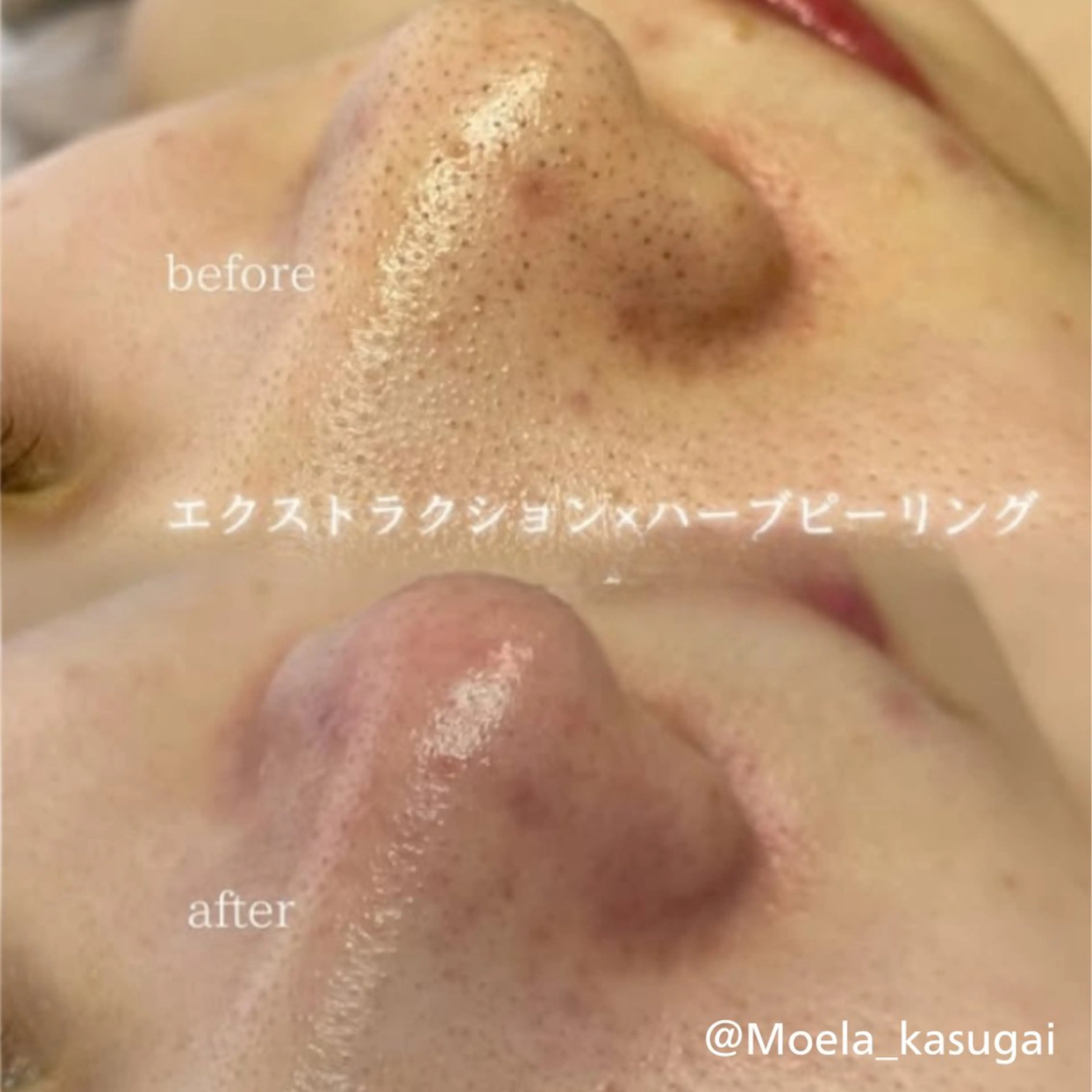 若山 遙子のエステ・リラクイメージ