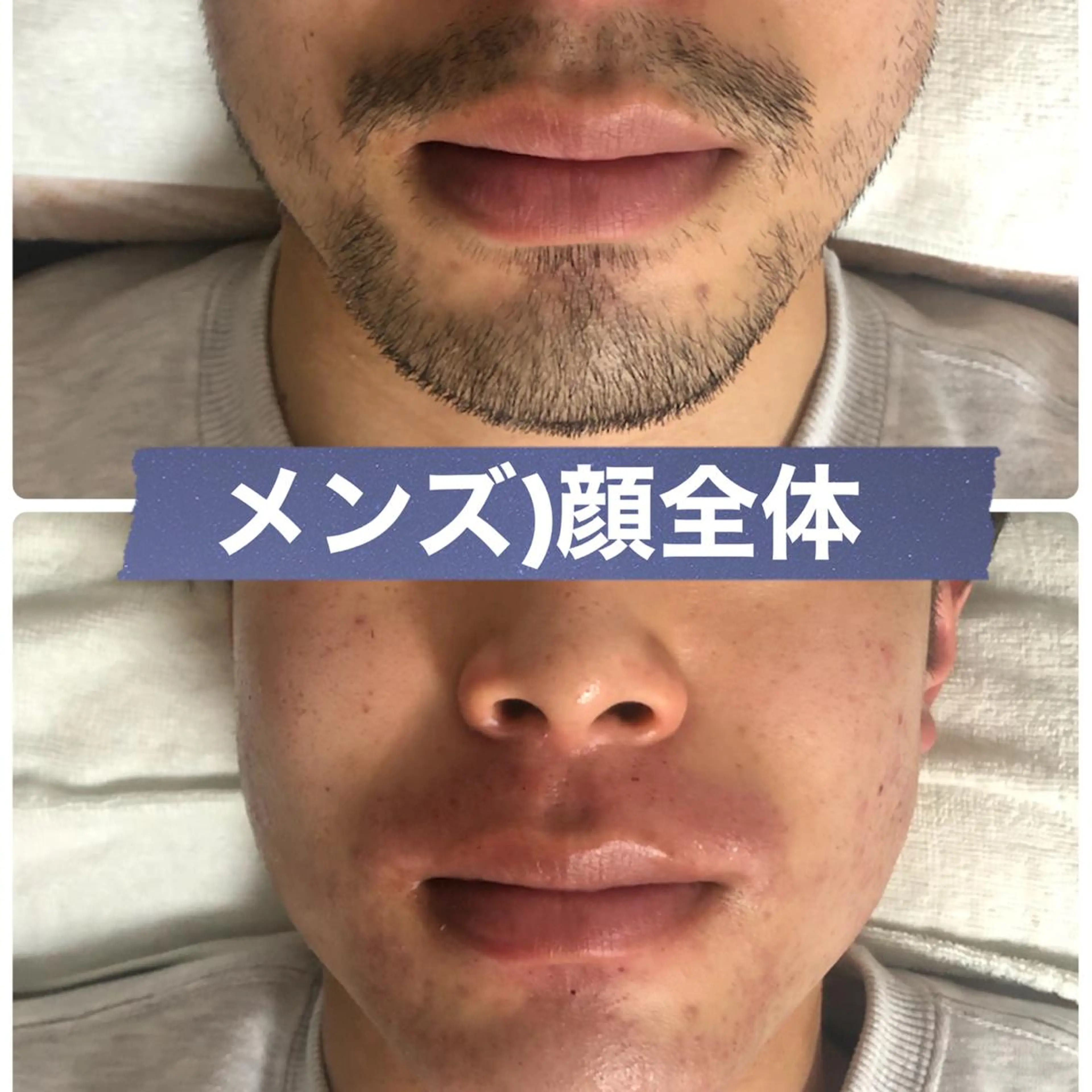 メンズ ブラジリアン☆WAX 🎖🌚YUKI🌚のエステ・リラクイメージ