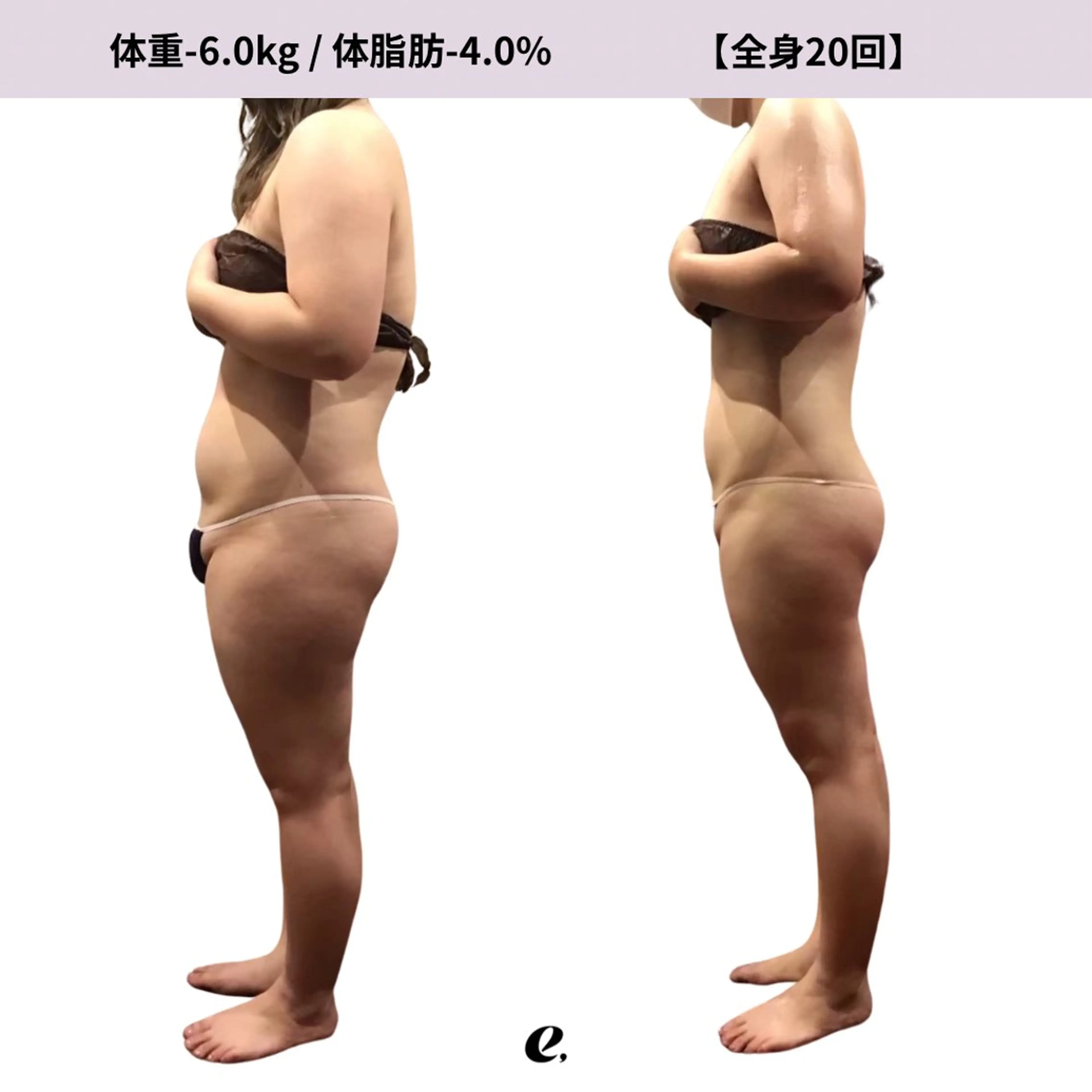 エステ リラク espresso,所属・《痩身、小顔専門店》 エスプレッソのエステ・リラクイメージ