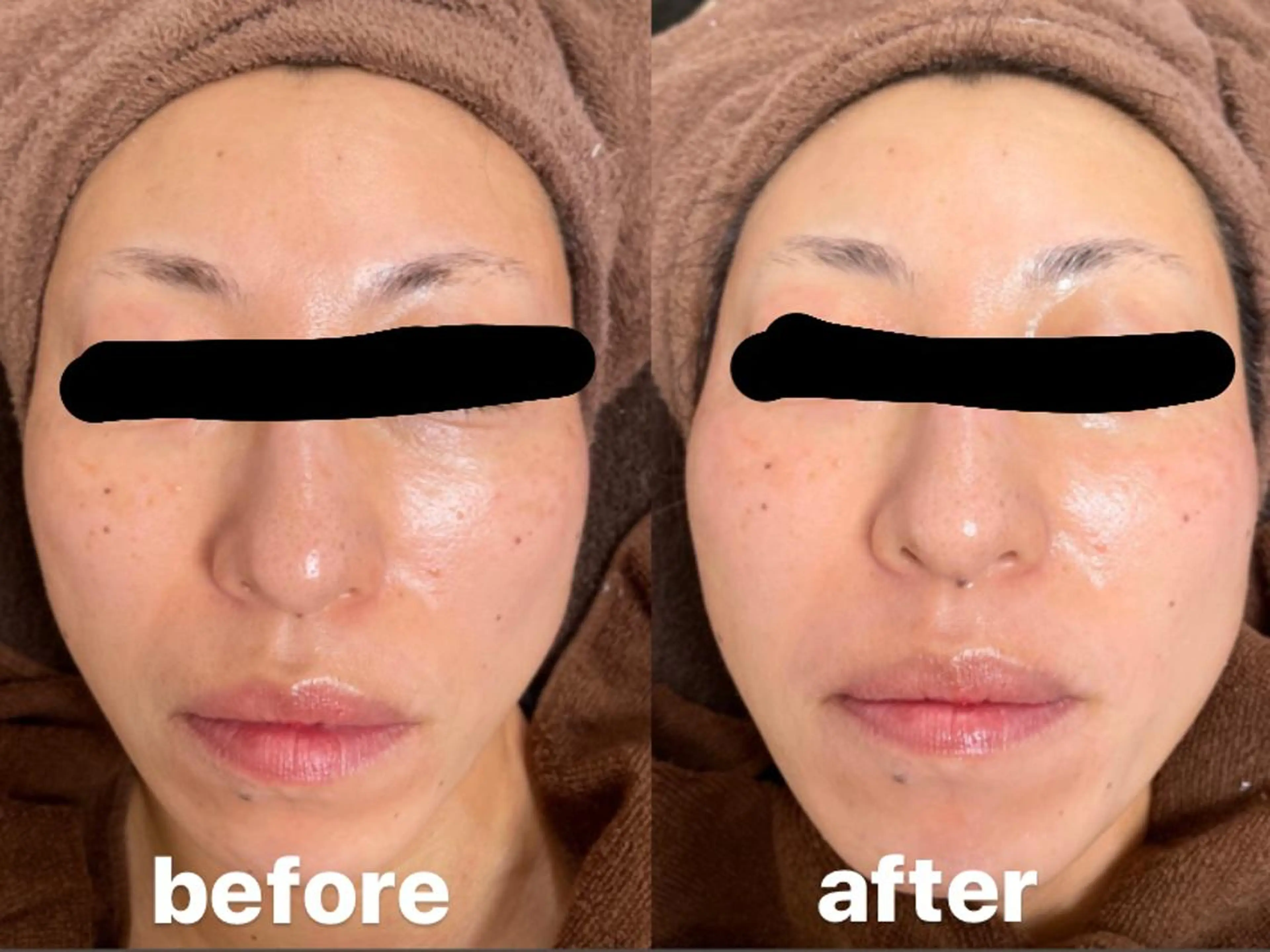 脱毛 emi ...の眉毛・アイブロウイメージ