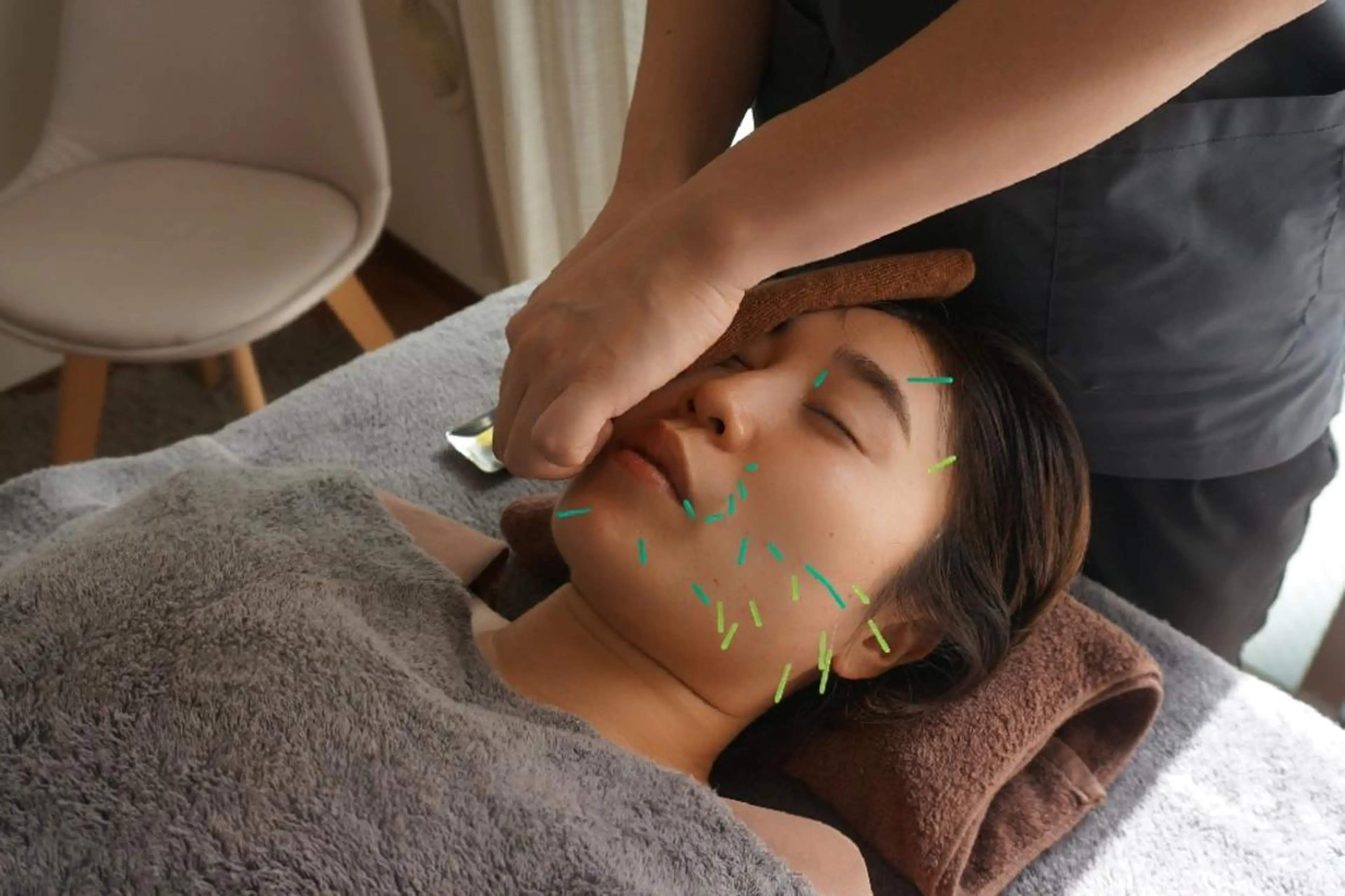 即効⚡小顔美容鍼🪡 むくみたるみ脂肪解消のエステ・リラクイメージ