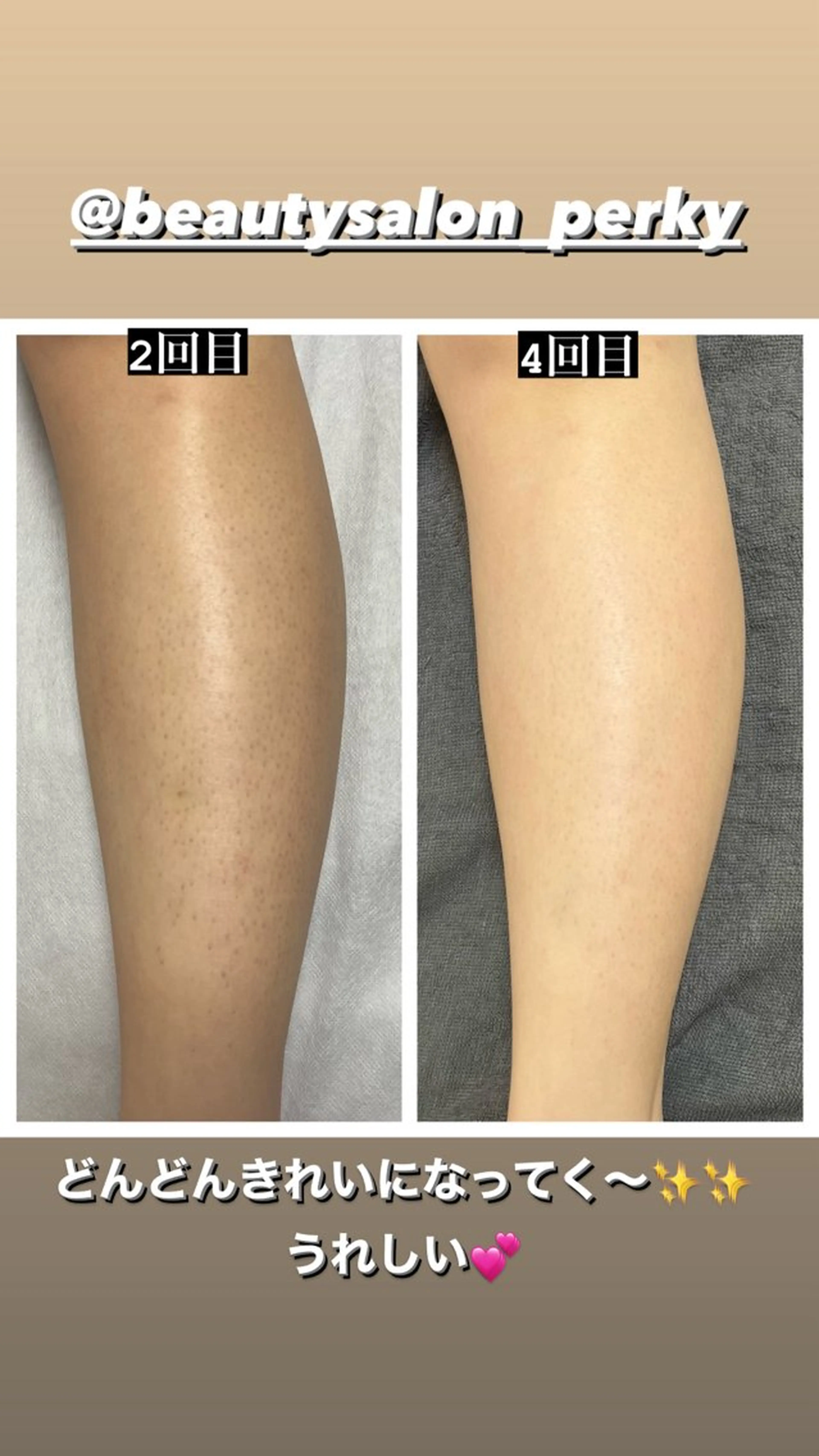 脱毛 perky所属・perky 羽島のマツエク・マツパデザイン