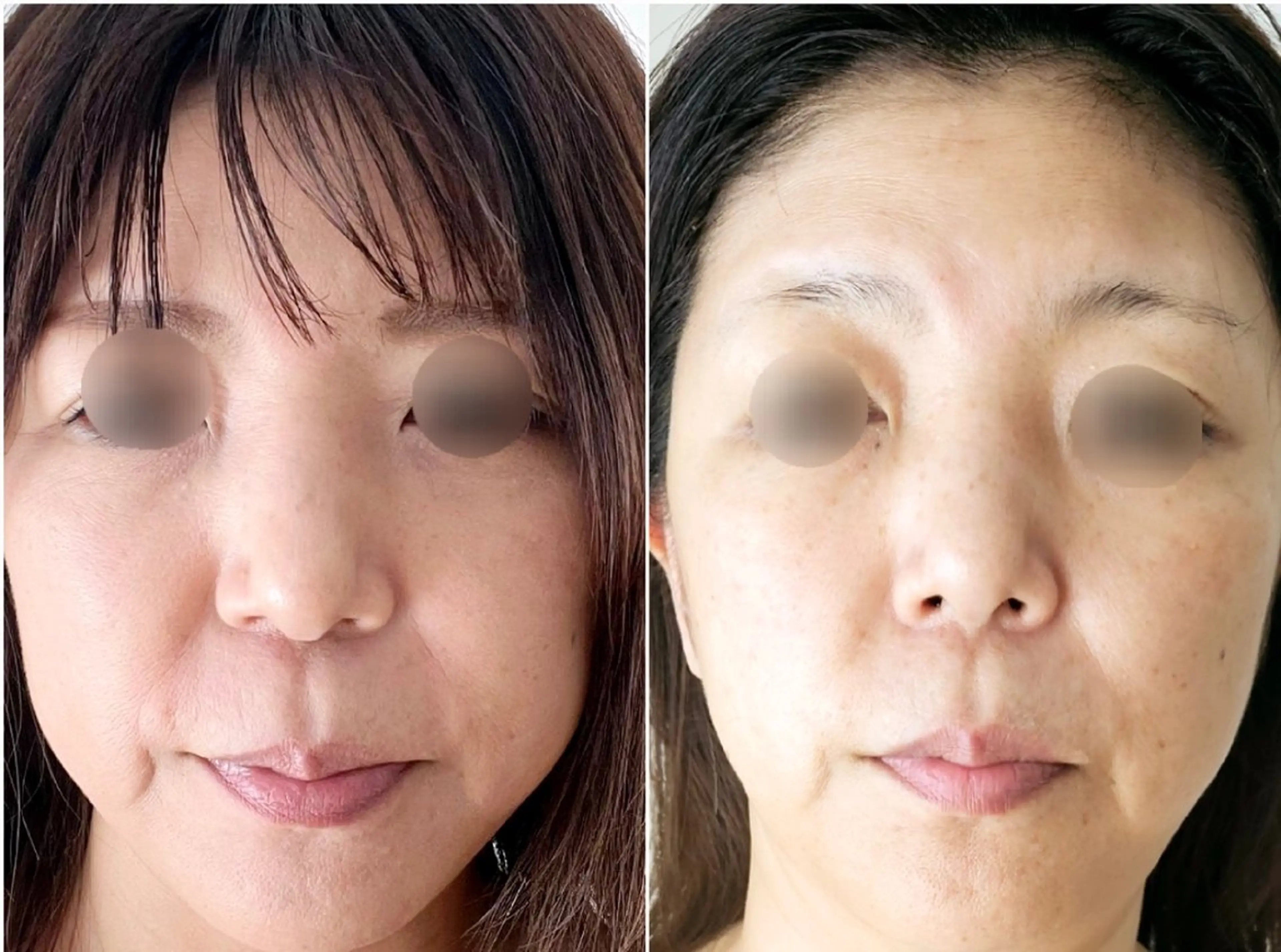 小顔・美肌ケア専門 Diva北浜のエステ・リラクイメージ