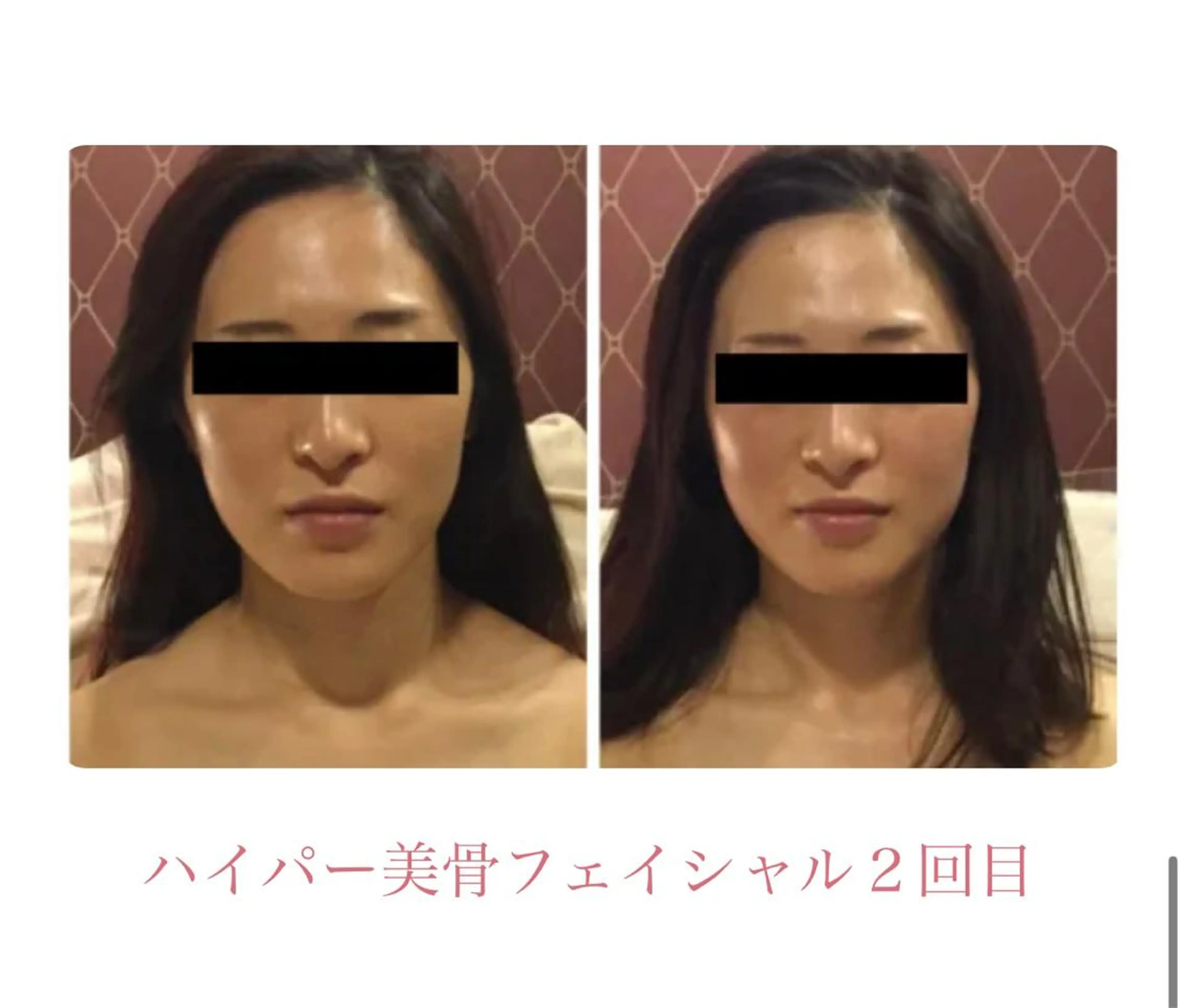 DEA  LUCE所属・痩身&小顔エステ DEA   LUCEのエステ・リラクイメージ