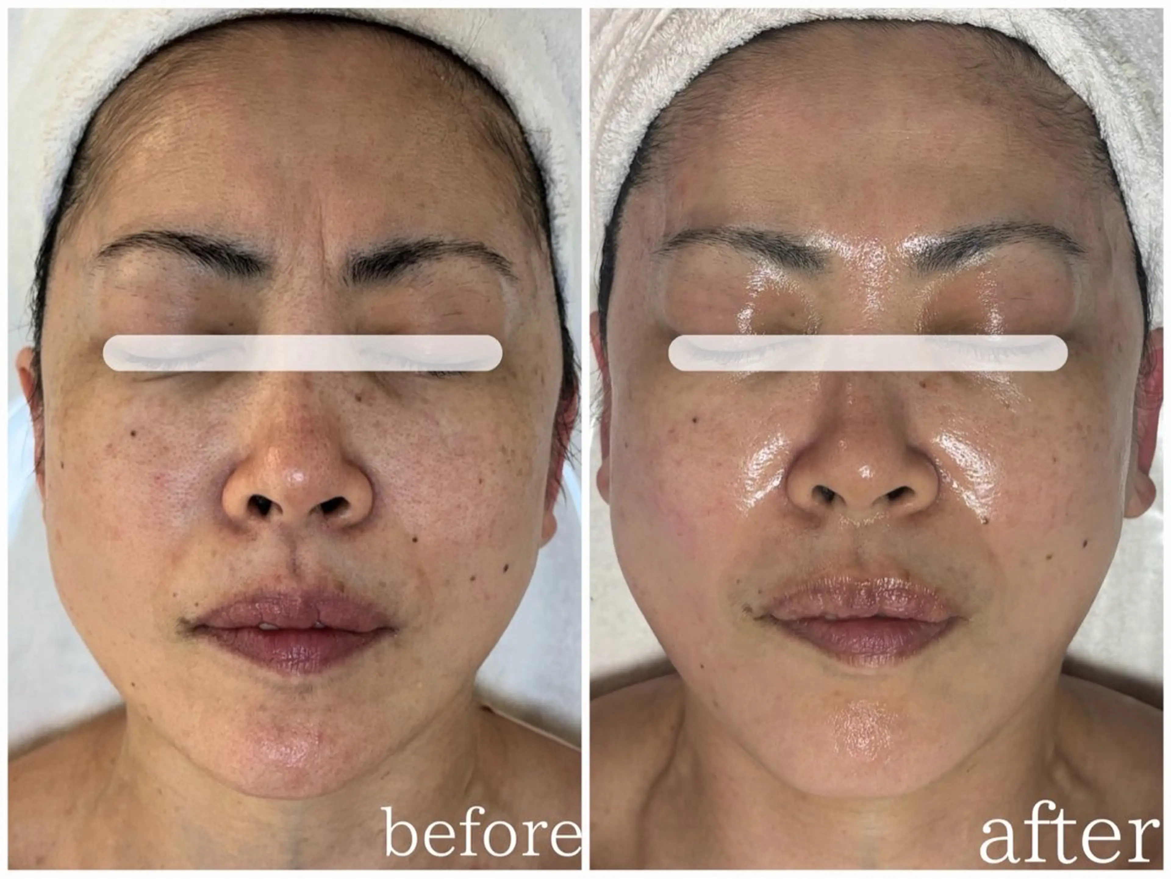 エステ リラク 田中For..天王寺 肌質改善/よもぎ蒸しのエステ・リラクイメージ