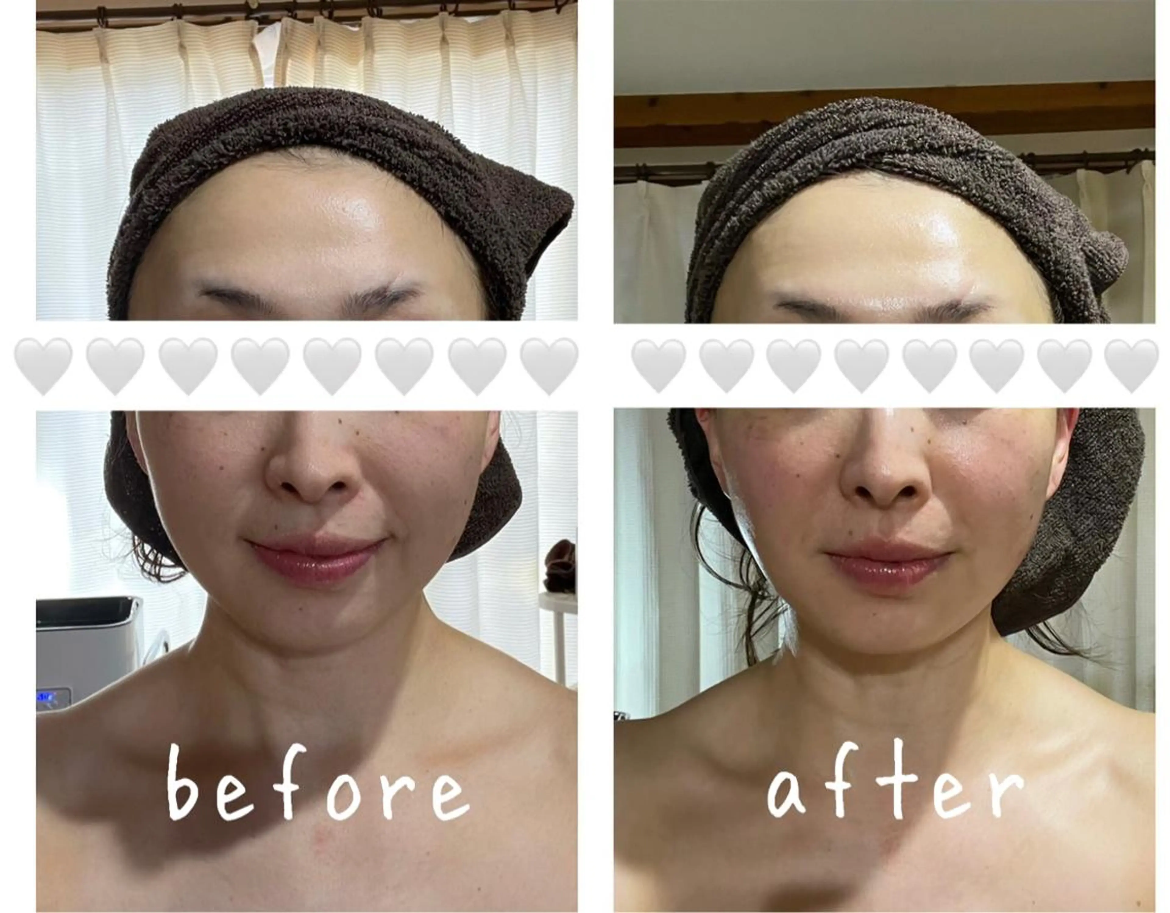 糸島 エステサロンmiuのエステ・リラクイメージ