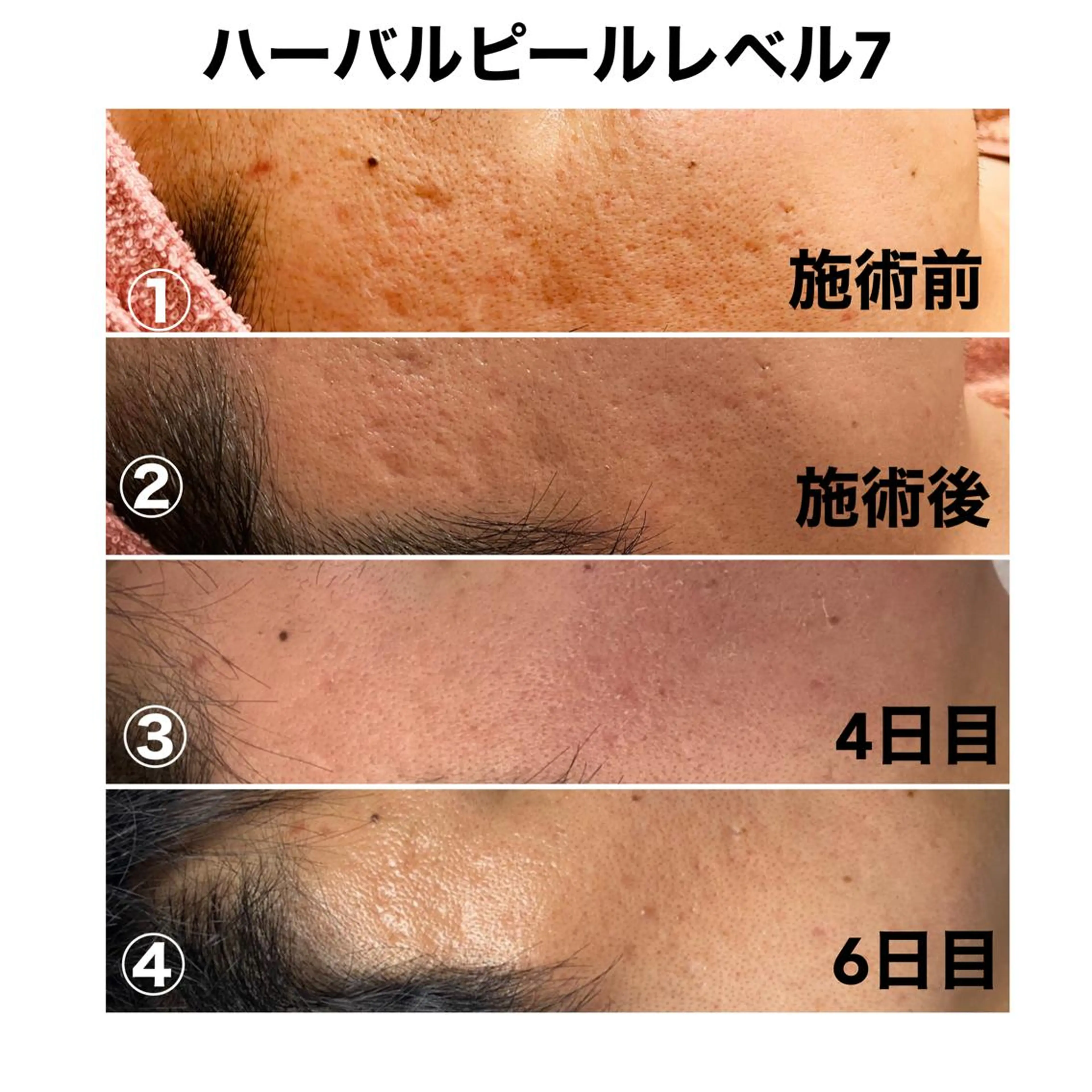 アロマ•ピーリング SalonYokoのその他イメージ