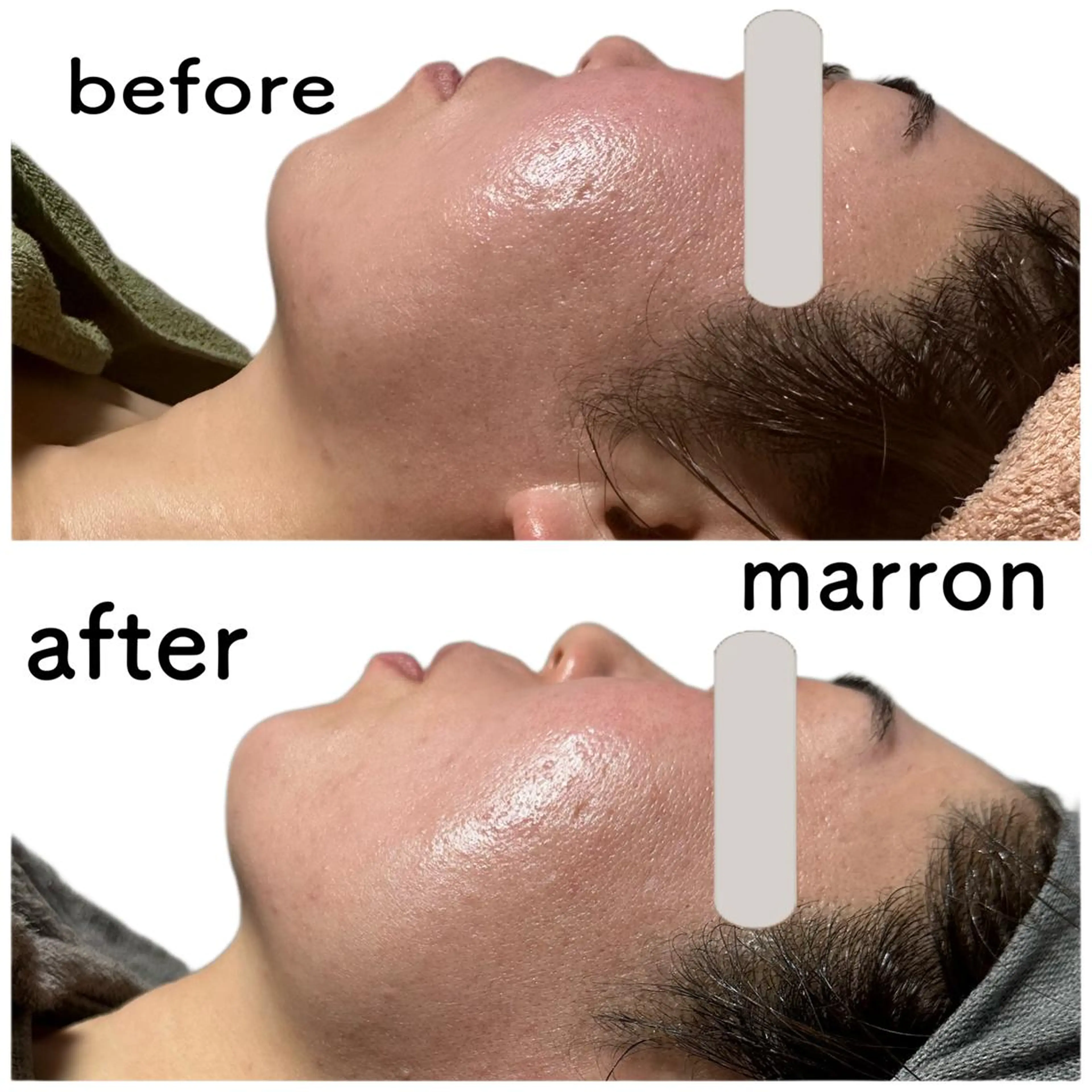 marron所属・痩身ハイパーナイフ ララピールリアボーテのエステ・リラクイメージ