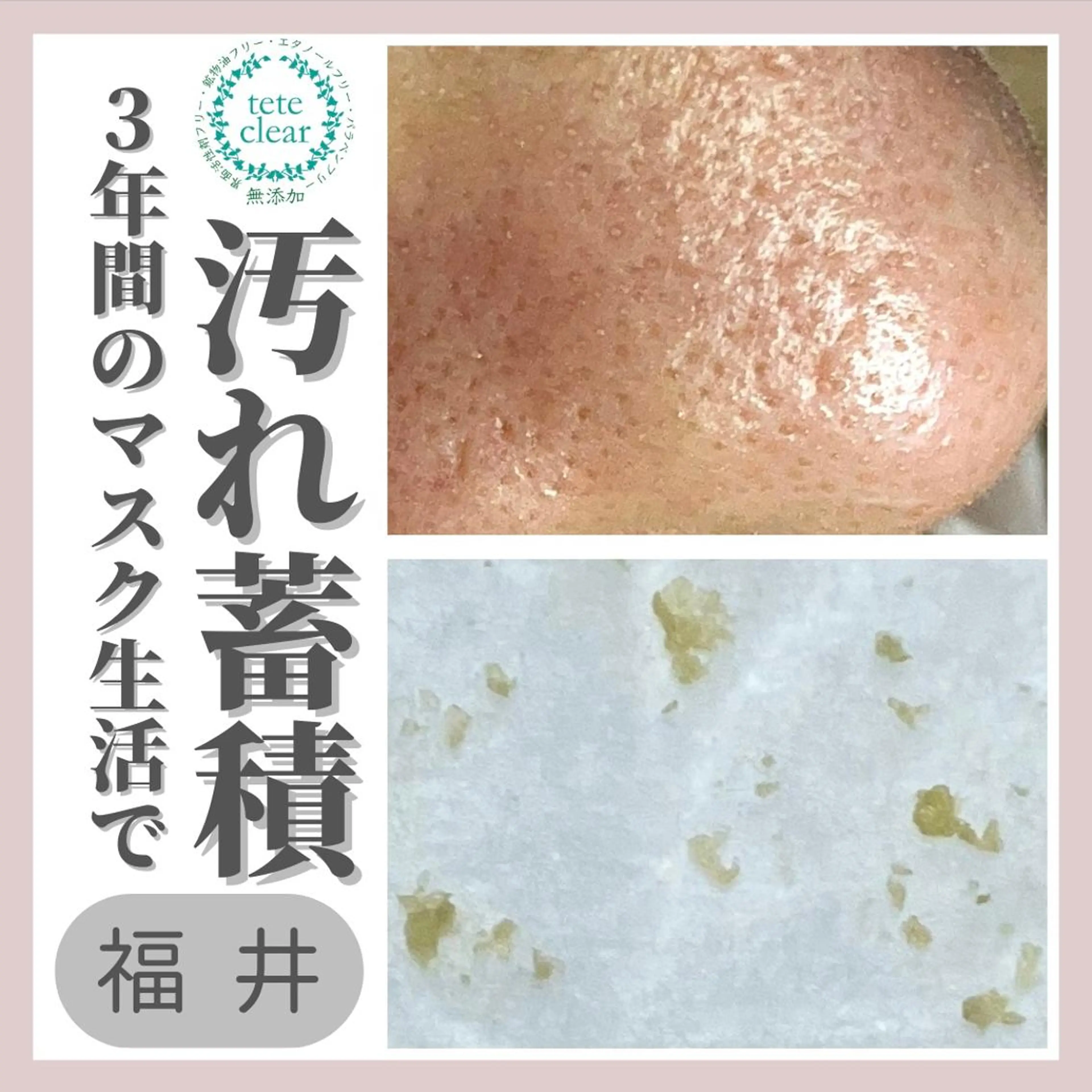 毛穴肌質ケアサロン Yourmeユアミーのエステ・リラクイメージ