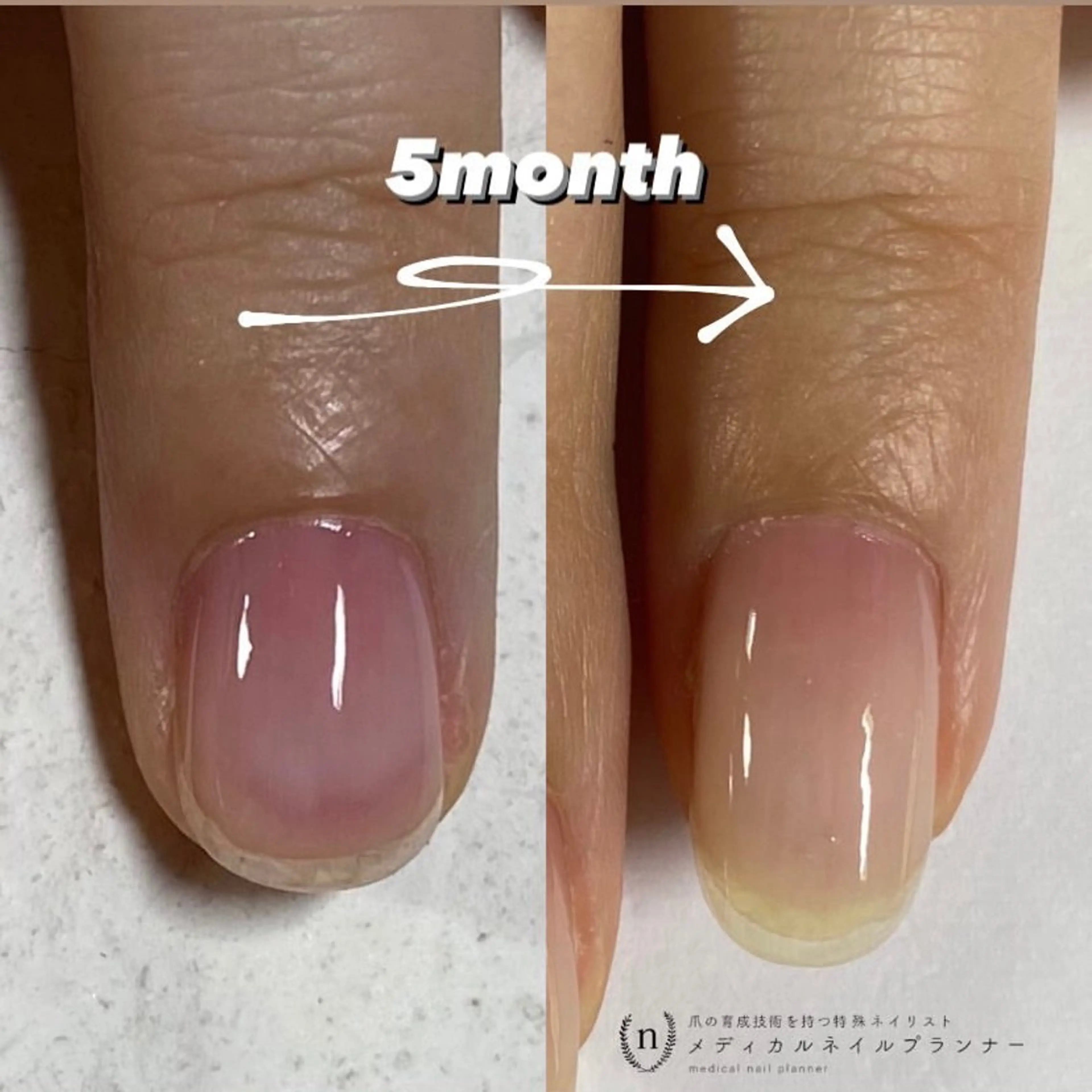 ネイル tsuki elfのエステ・リラクイメージ