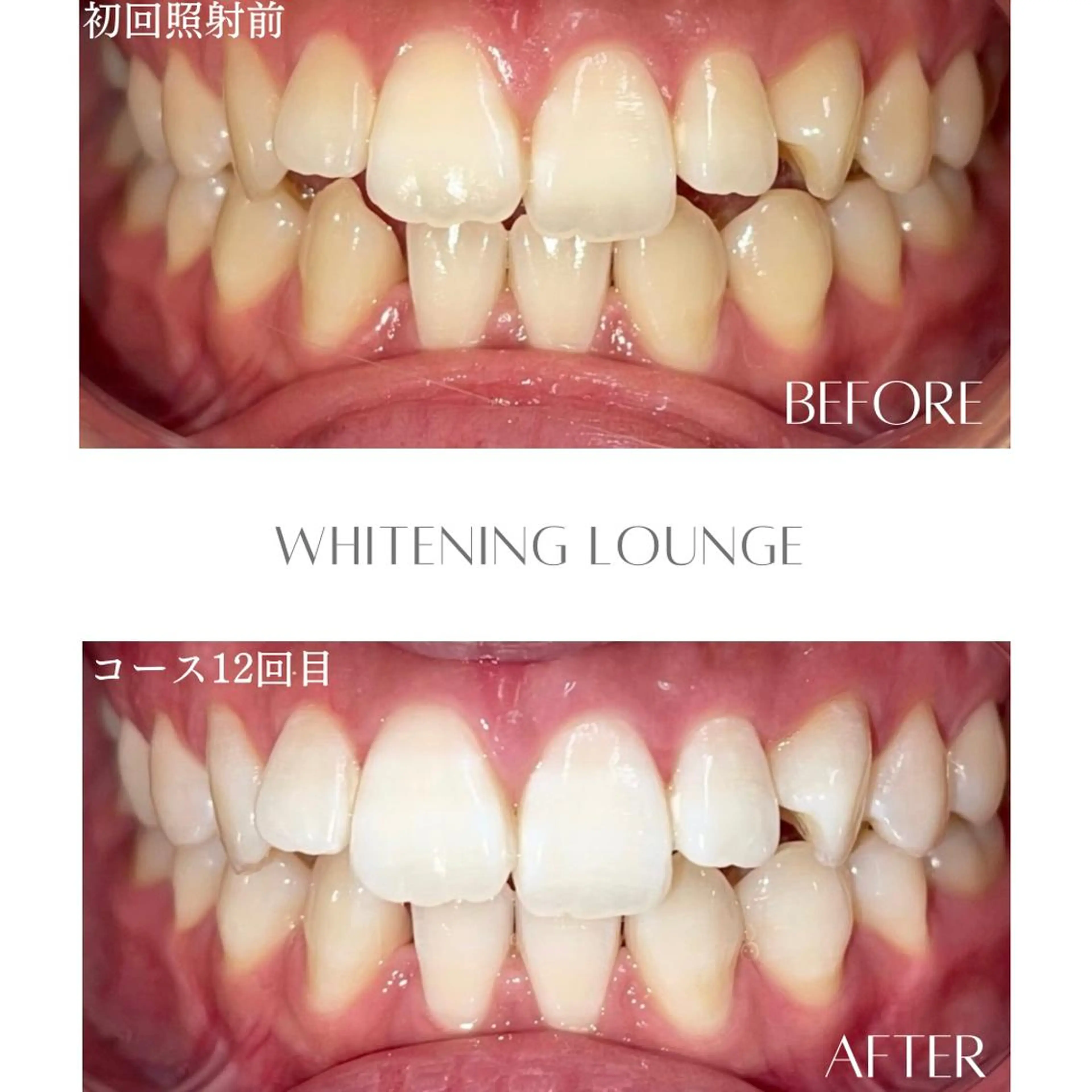 その他 ホワイトニングラウンジ横須賀所属・ホワイトニング Lounge横須賀のその他イメージ