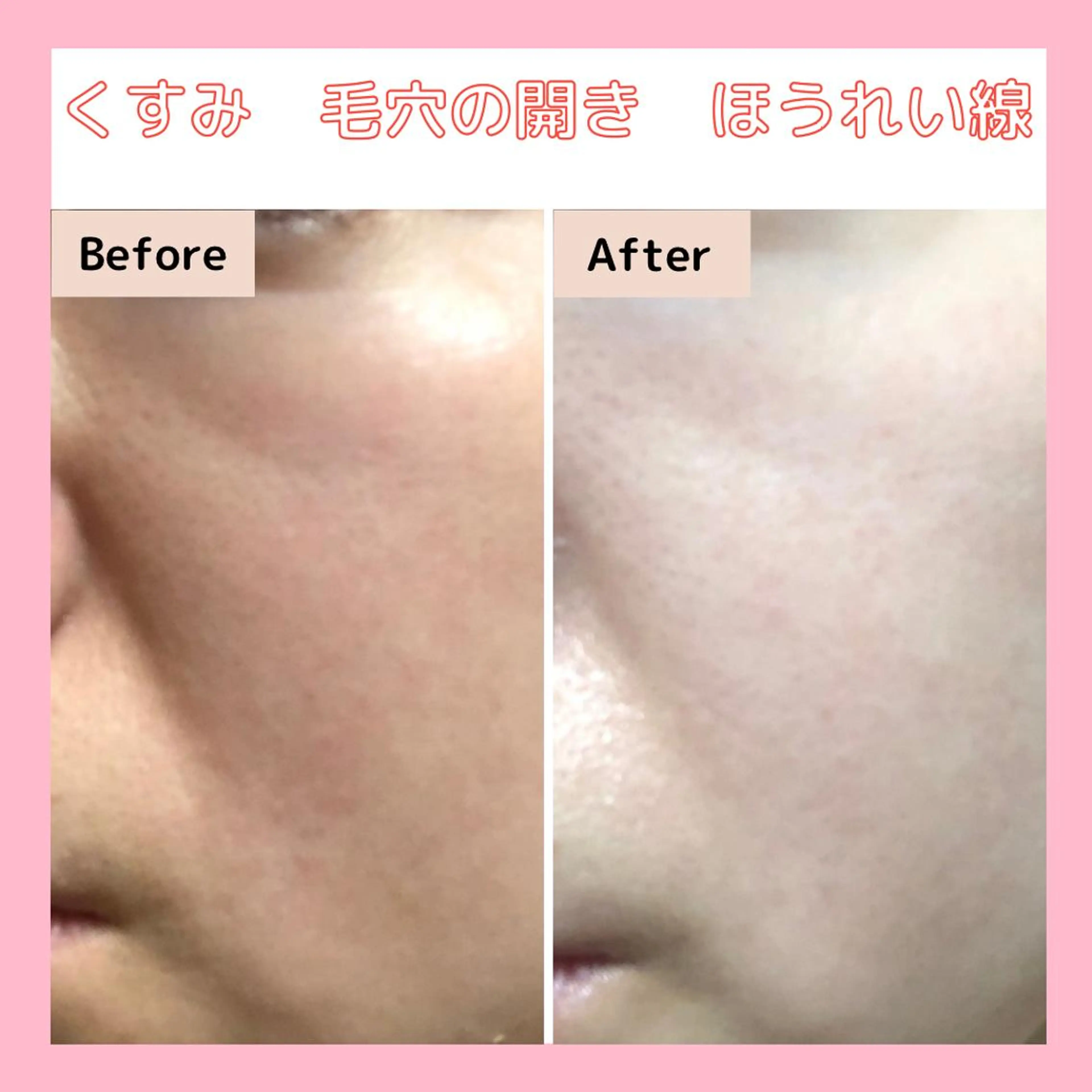 エステサロン　Sブランペタル所属・三沢市エステサロン Sブランペタルのエステ・リラクイメージ