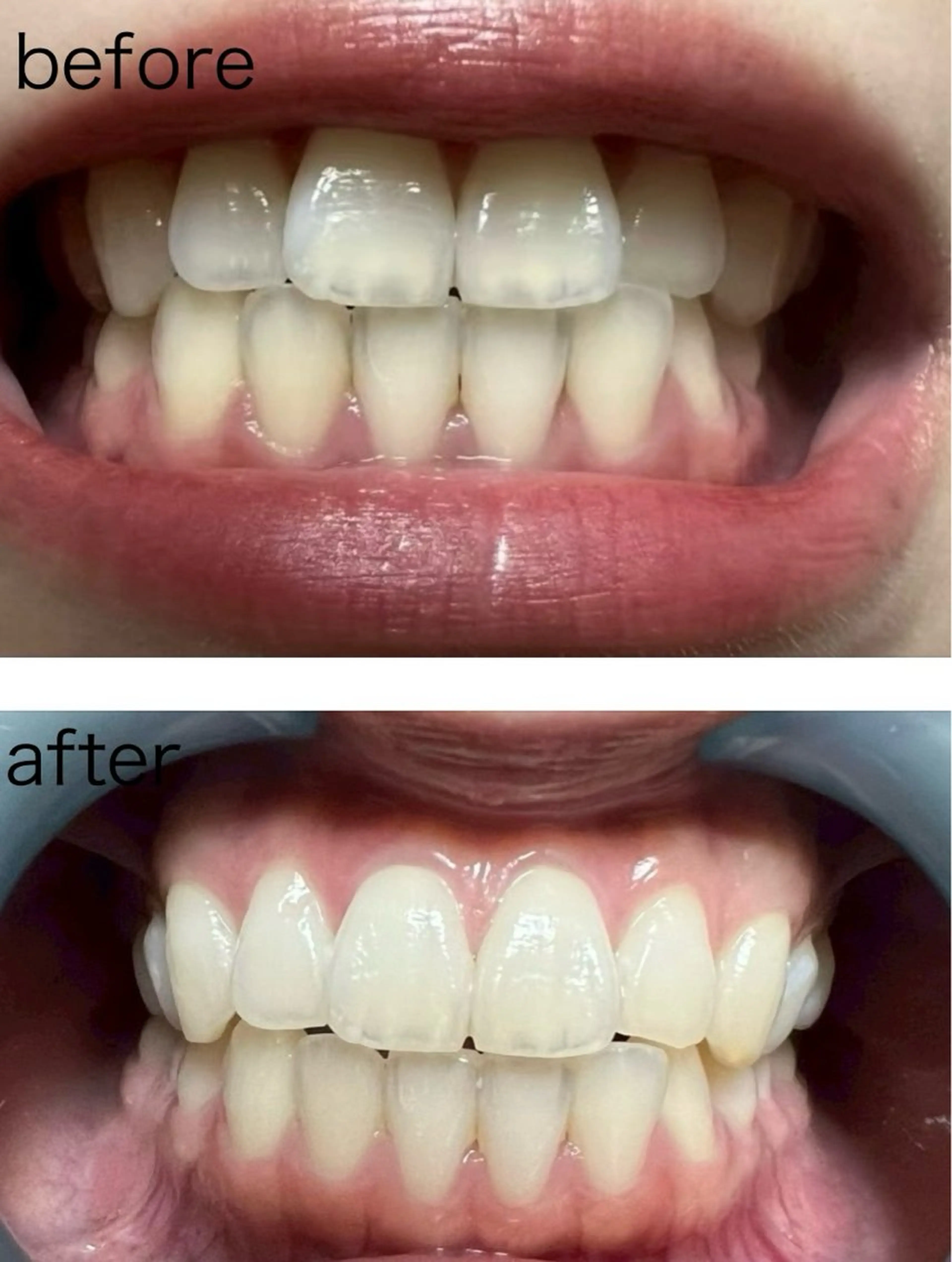 irooo 21のネイルデザイン