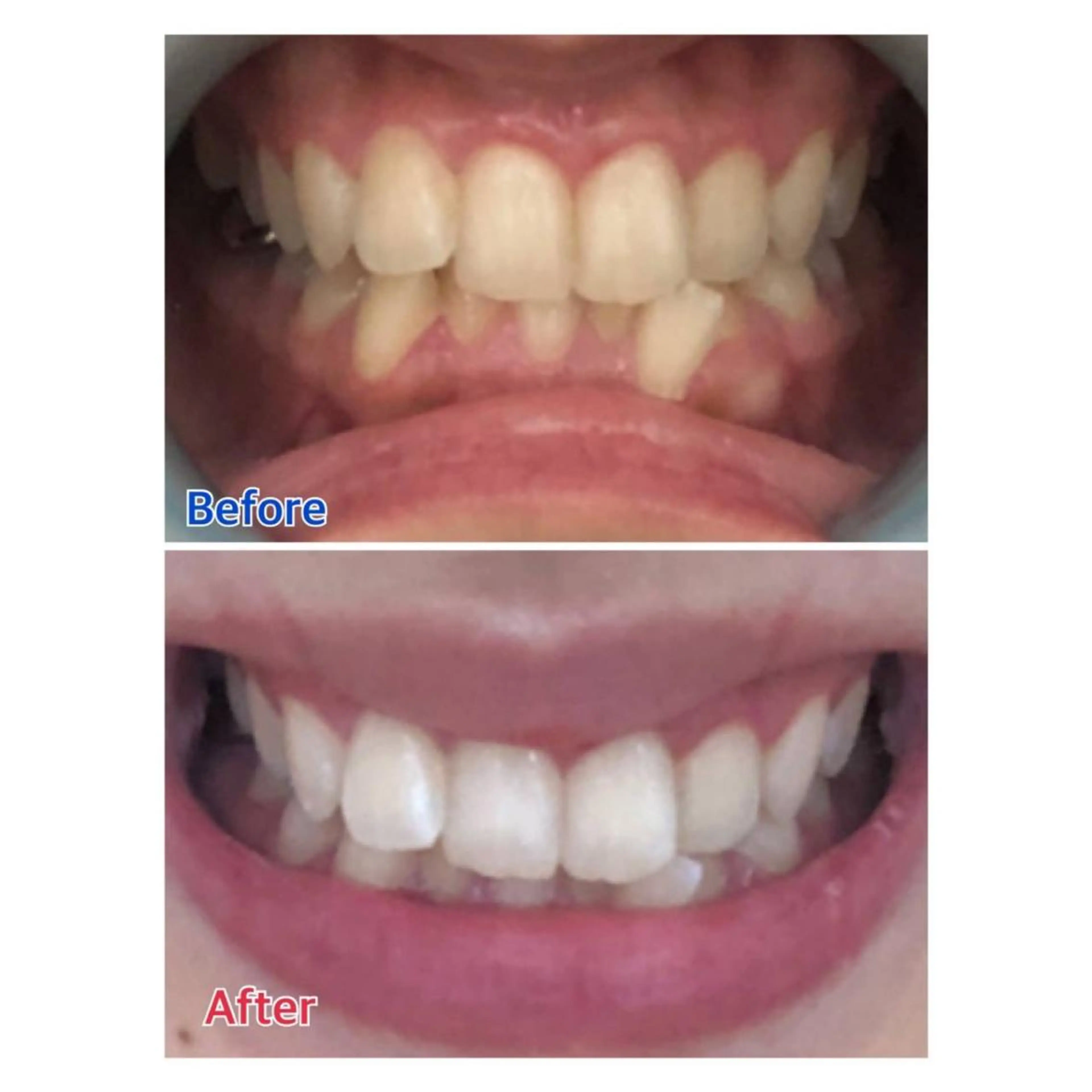 MBEAUTYSALON 千葉店・京成大久保所属・Melty 輝のその他イメージ