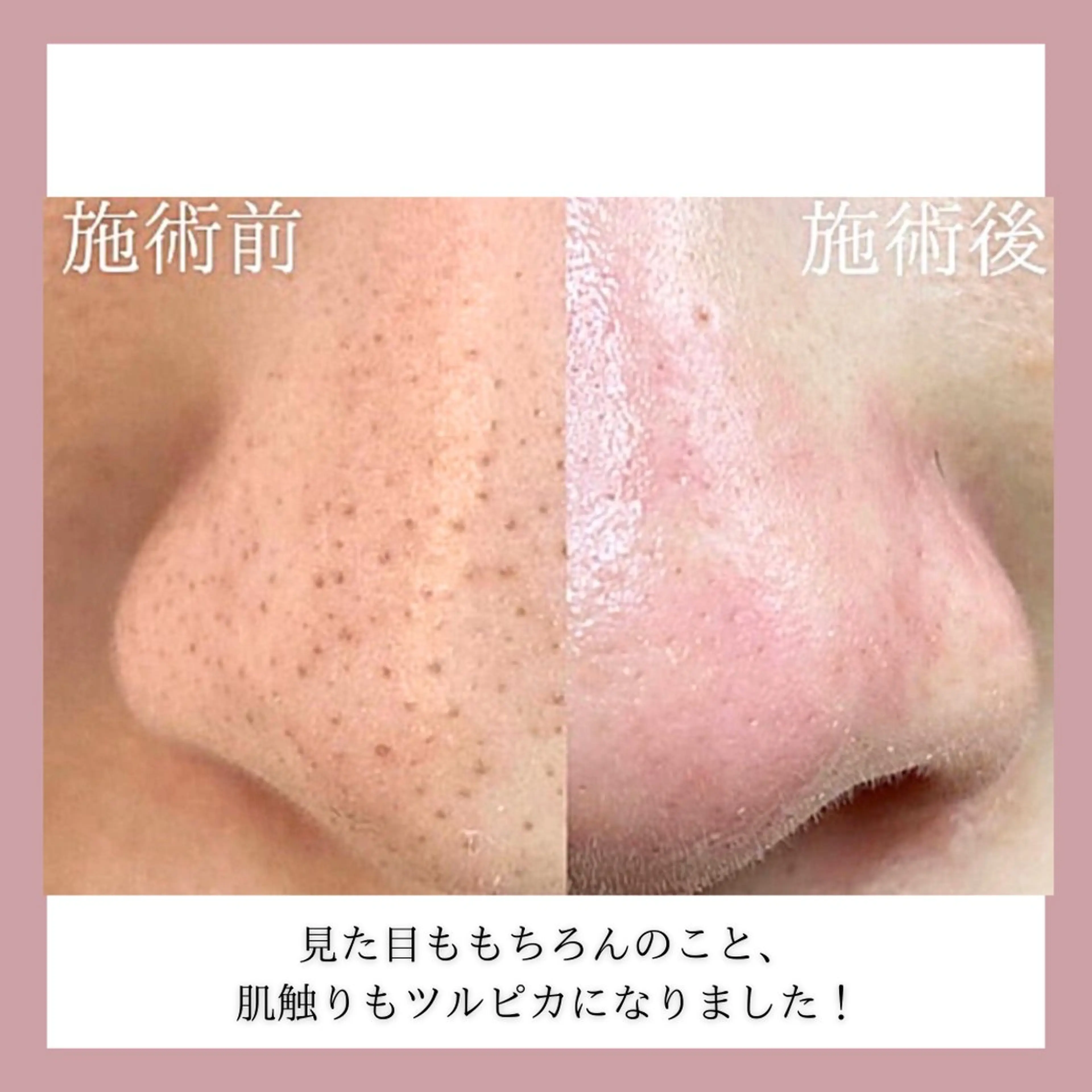 美肌脱毛&毛穴専門 Nico🐰ྀི♡のエステ・リラクイメージ