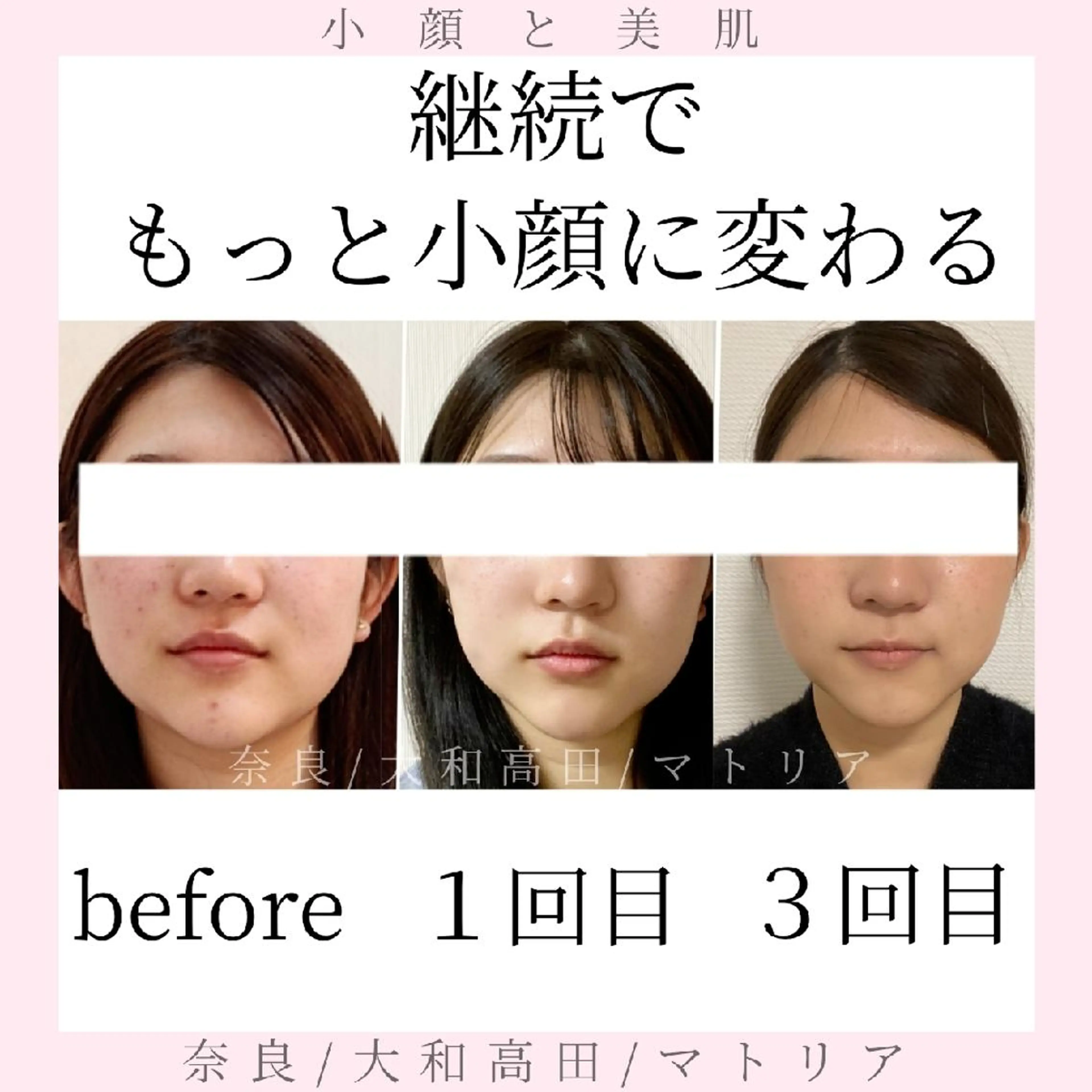 小顔と美肌 まごころエステMatoria所属・小顔 美肌専門 Matoriaのエステ・リラクイメージ