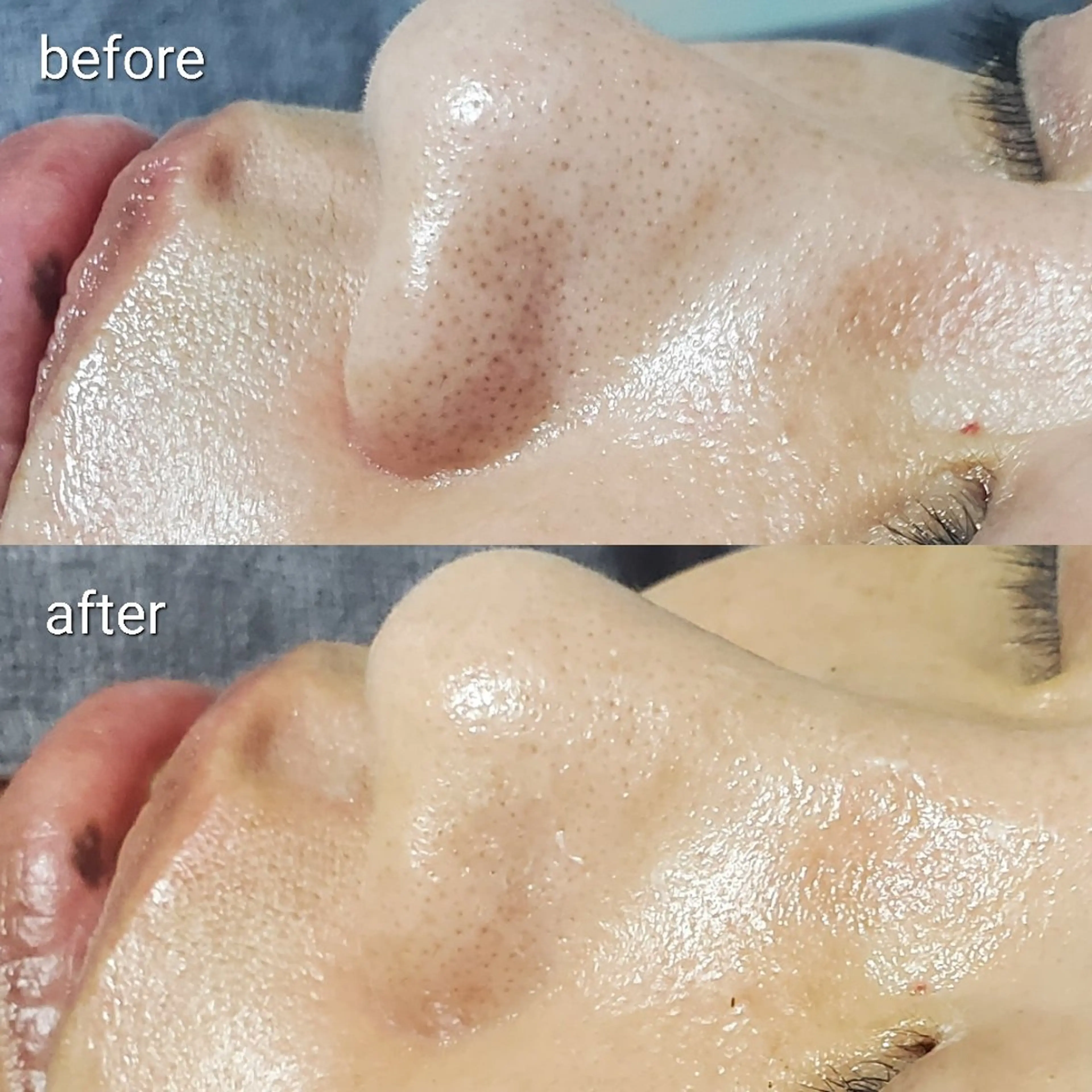 オーガニックエステ サロン　Graceのエステ・リラクイメージ