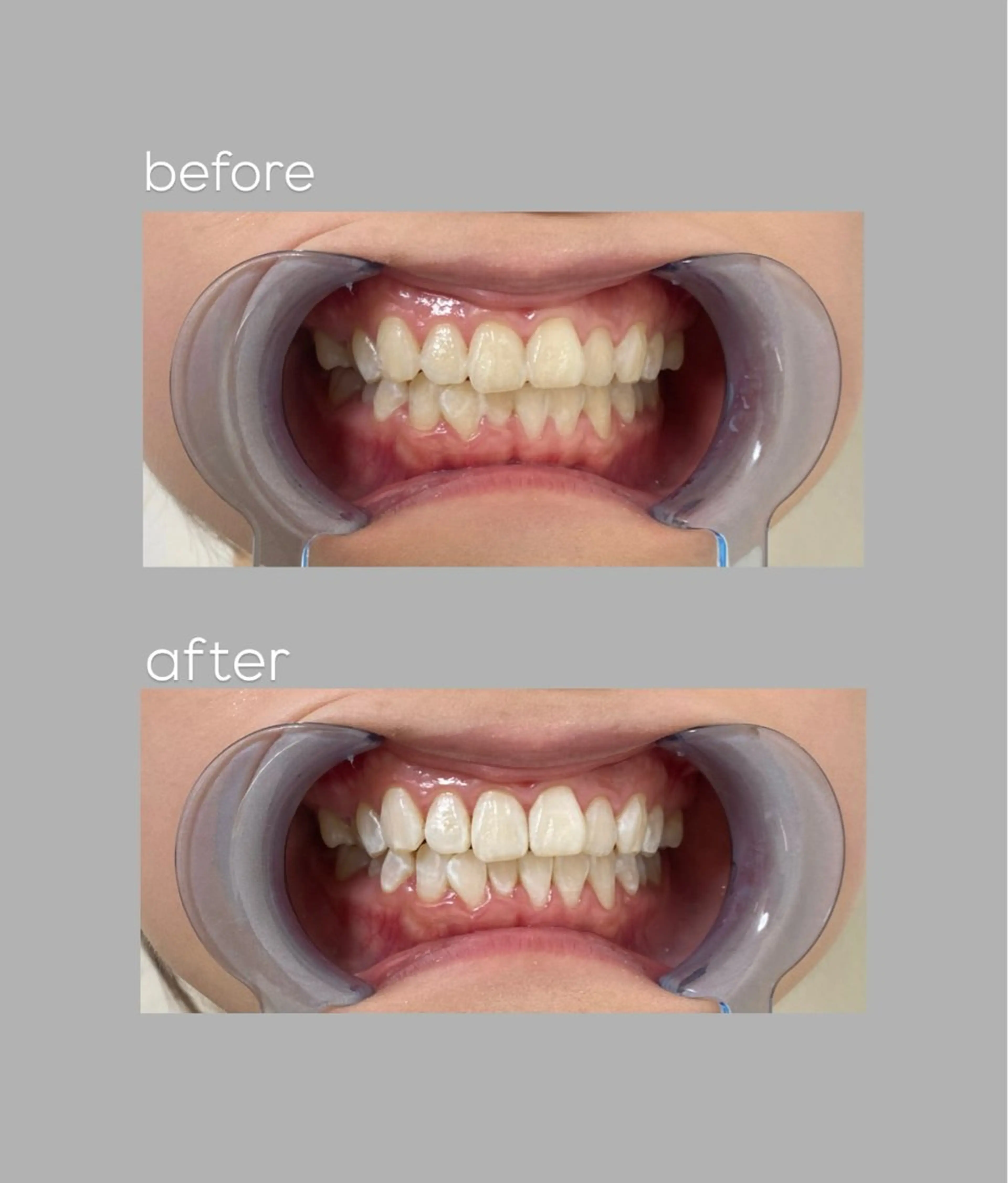 White33所属・aoi 🦷❤︎のその他イメージ