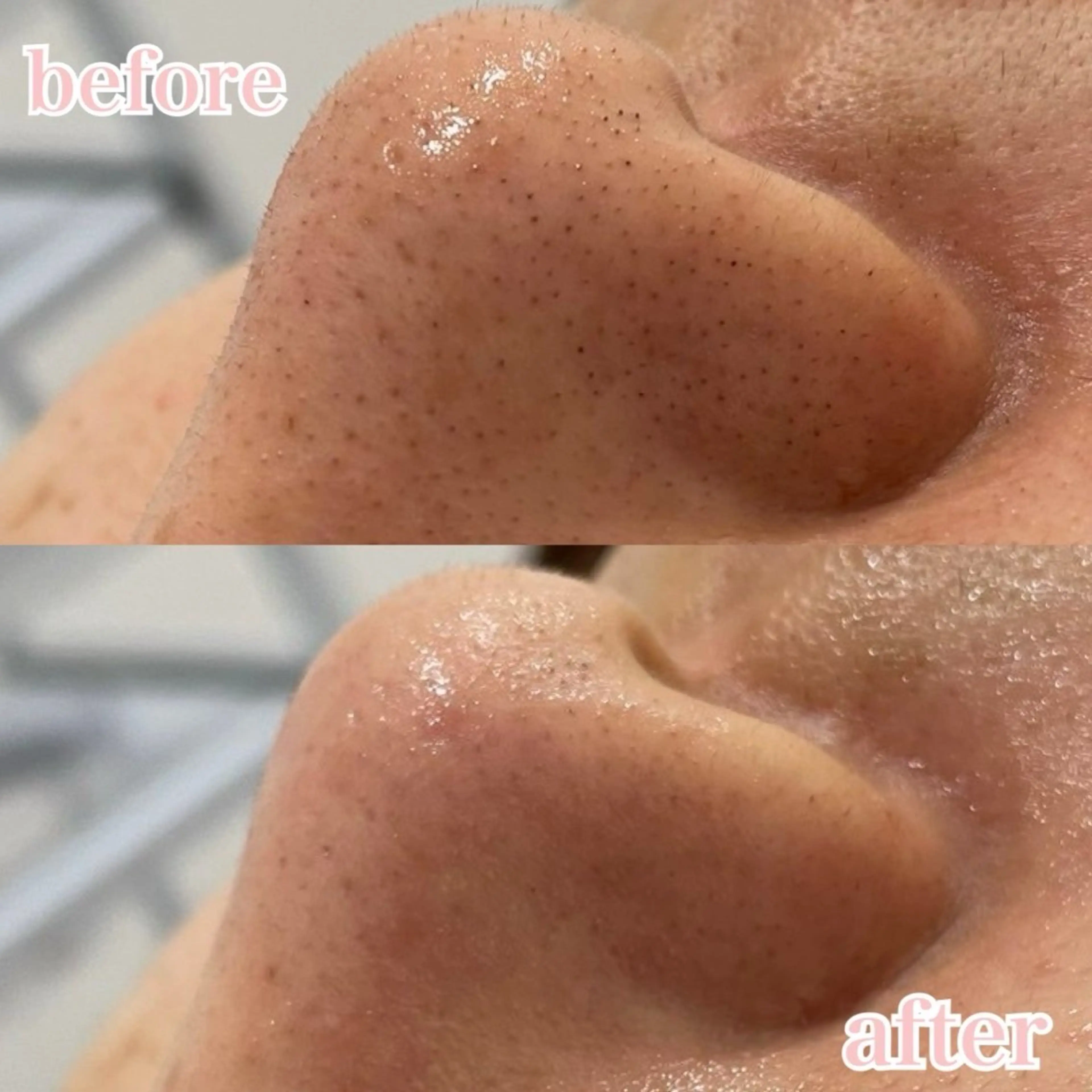 肌管理専門店Whitelabo堺東店所属・おだ あみのエステ・リラクイメージ