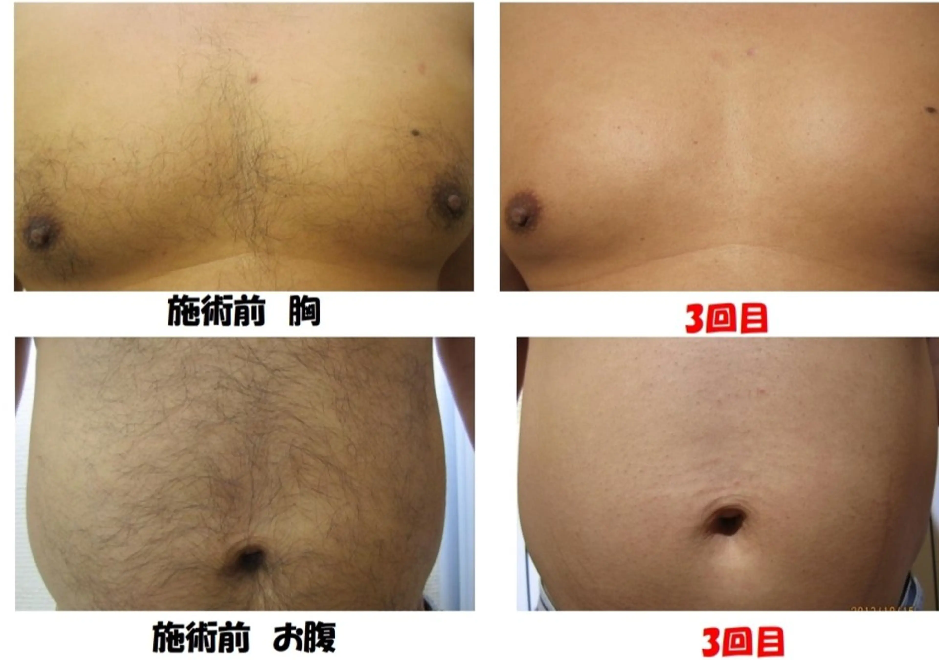 Salon Ree Belle(サロン リベル)所属・サロン リベル YUKAのエステ・リラクイメージ