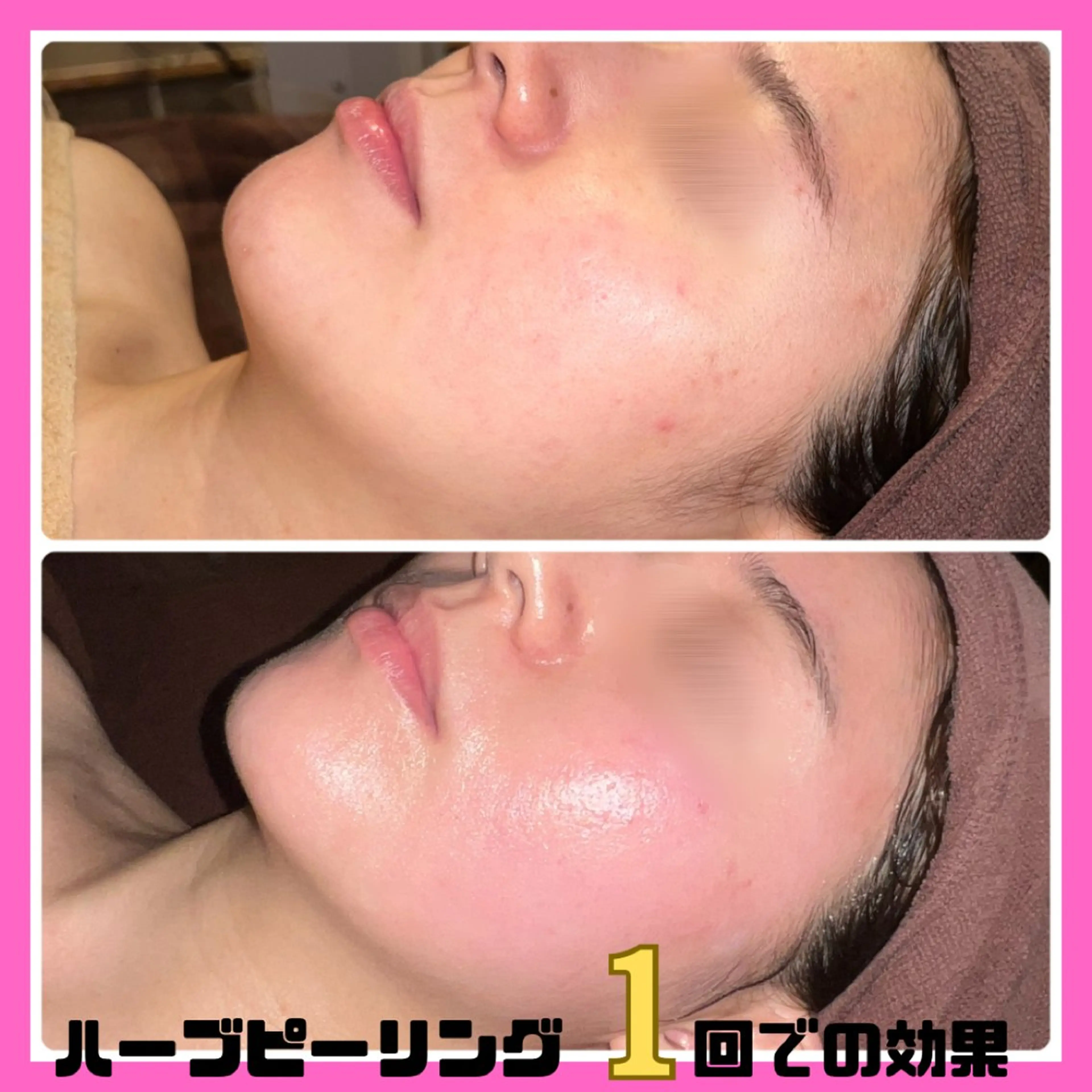 エステ リラク 痩身&美肌サロン 堀米✨のその他イメージ