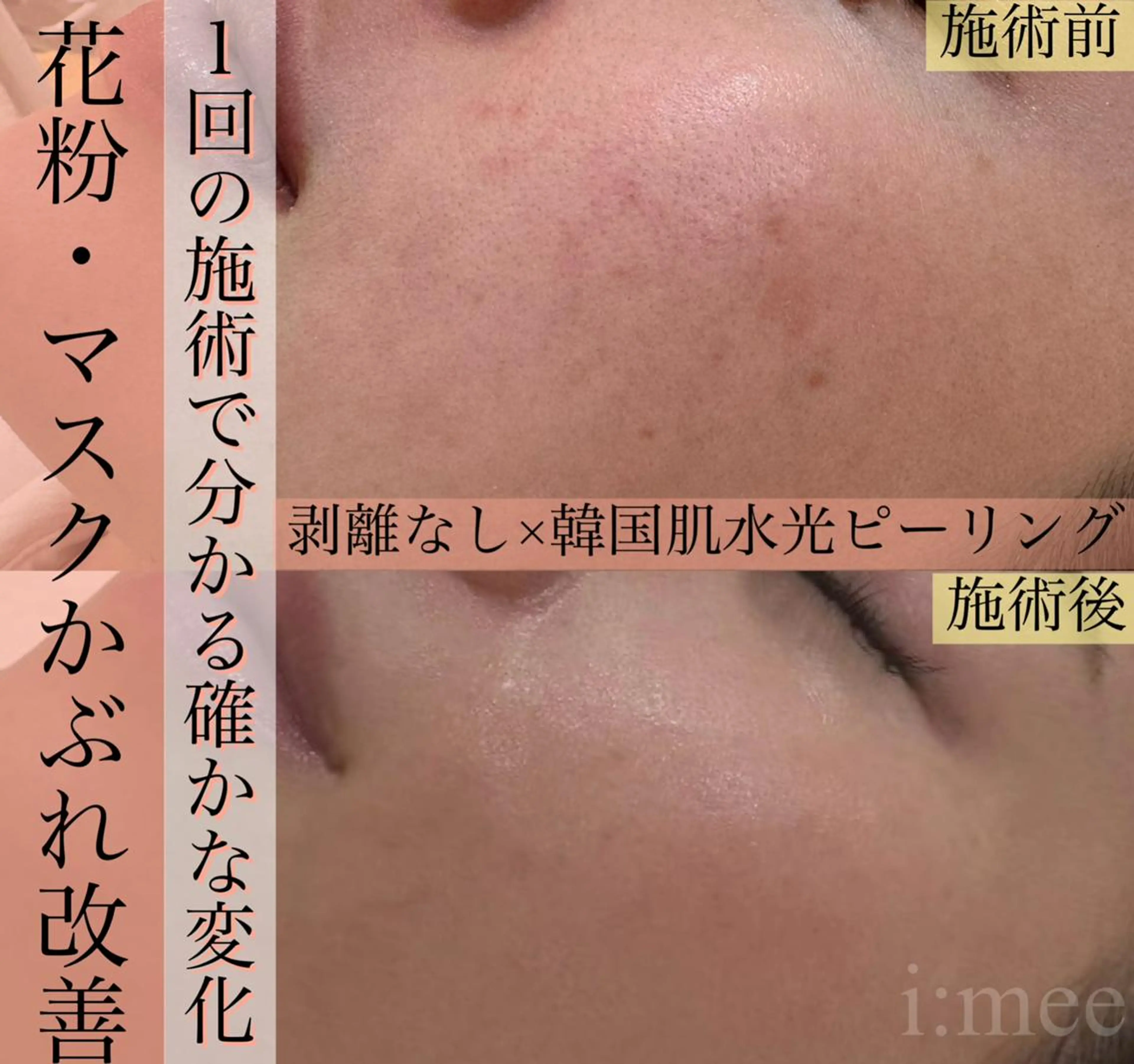 Jr.ネイリスト 森田のネイルデザイン