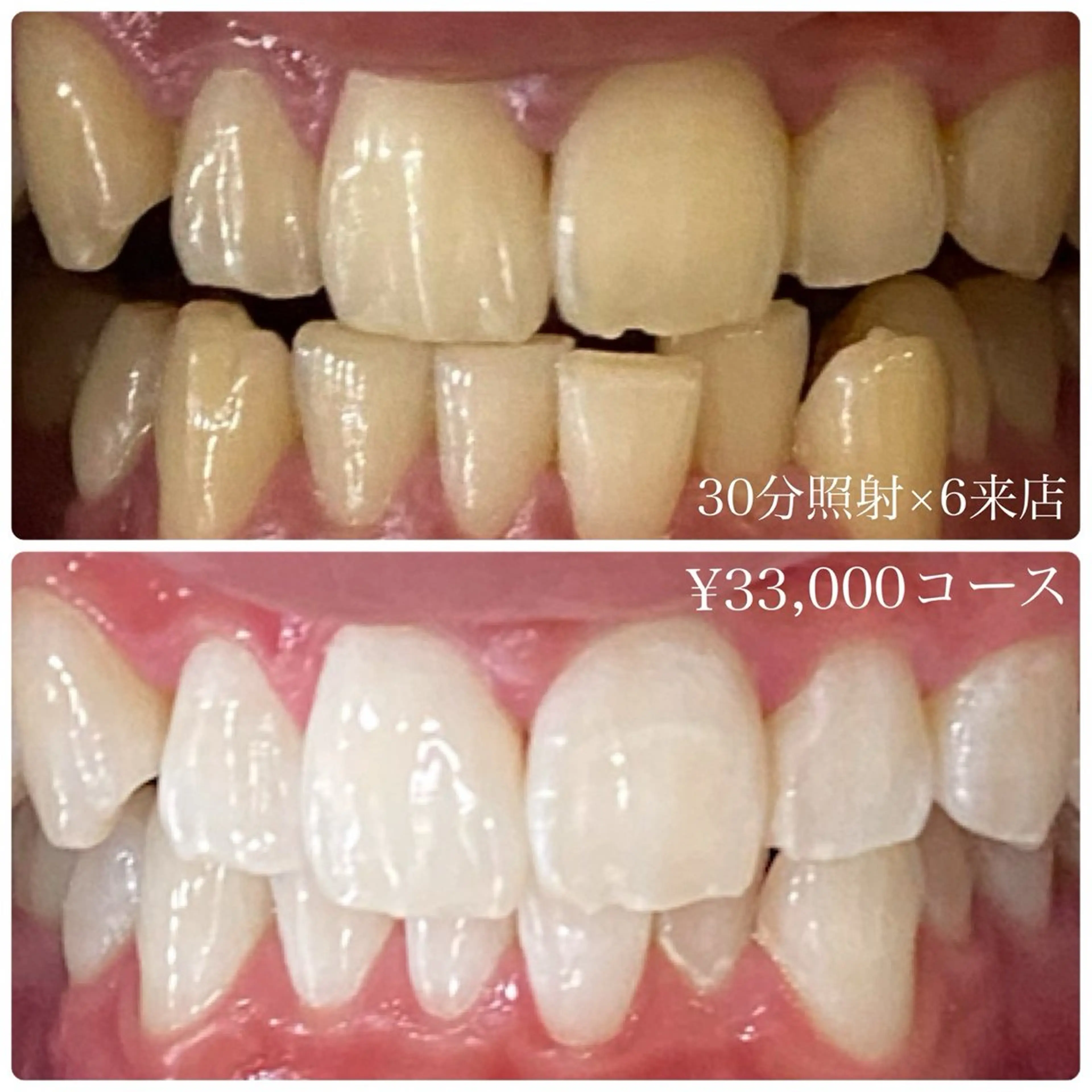 PLATINUM Beauty 横浜店所属・ホワイトニングルーム 横浜店のその他イメージ