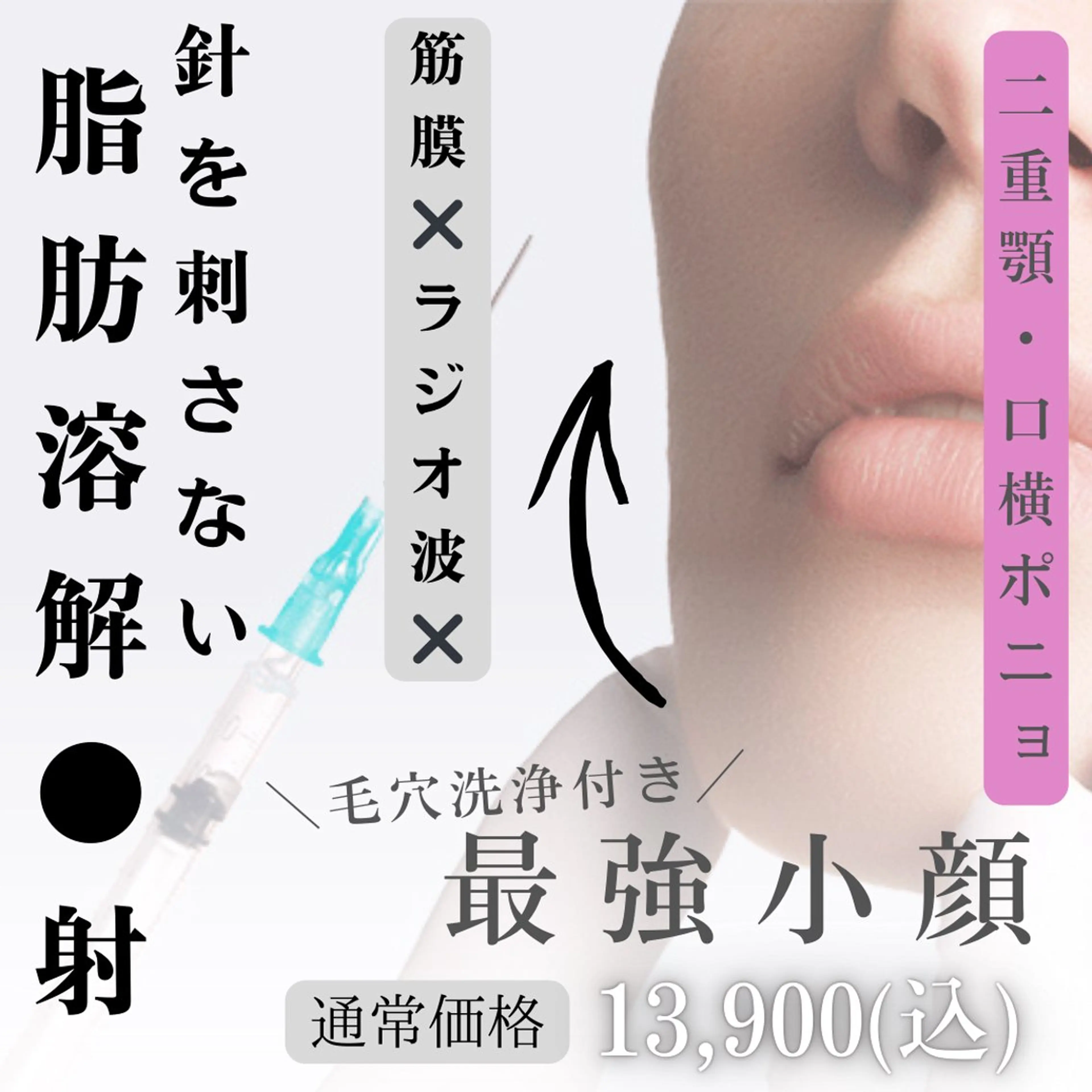 【二重顎.たるみに◎】最強小顔/毛穴洗浄×筋膜リフト×ラジオ波×脂肪◯解2cc注入 約50分の写真