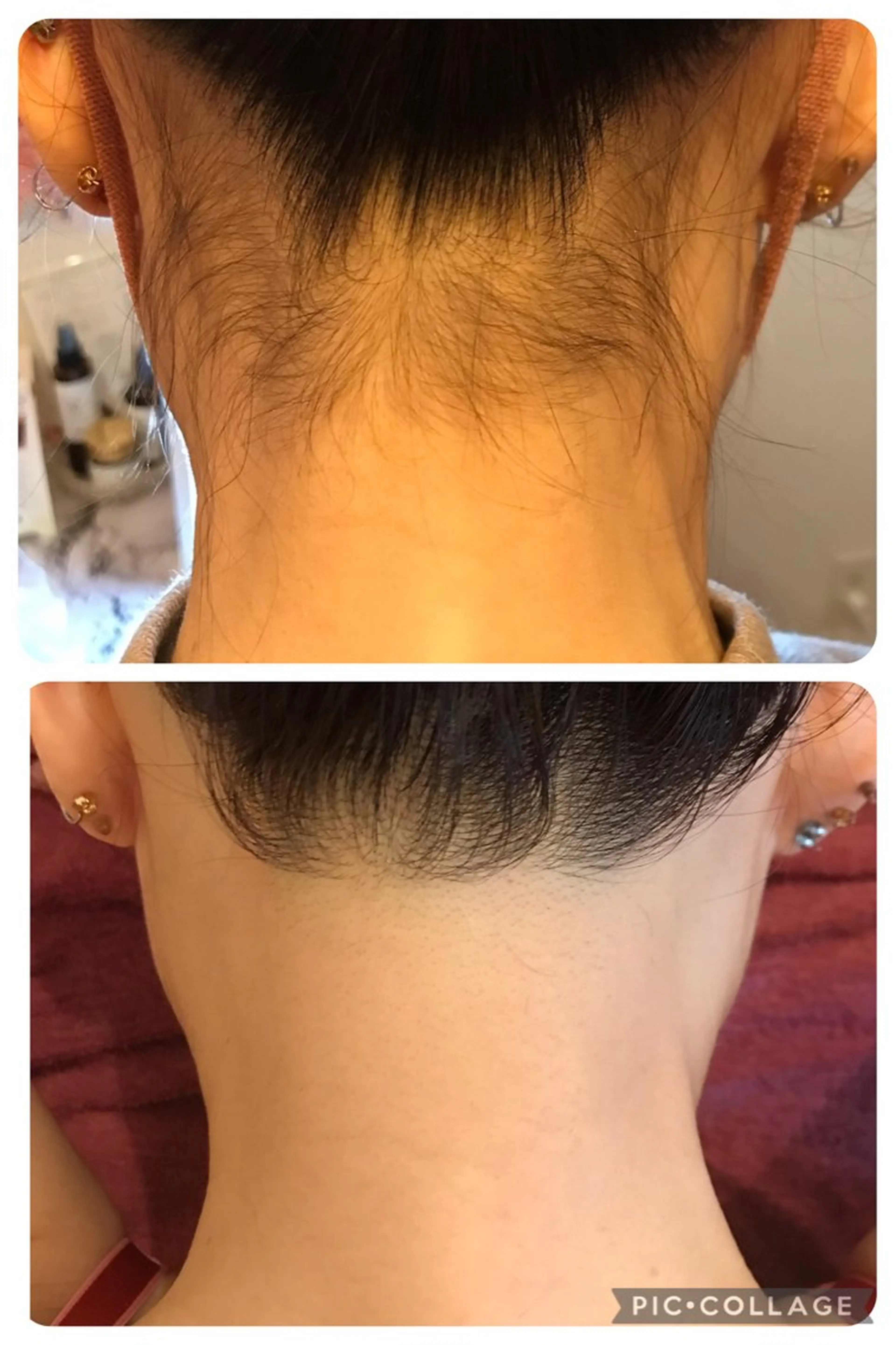 🌻minimo限定🌻【うなじ脱毛＋背中全体1回2,900円】の写真