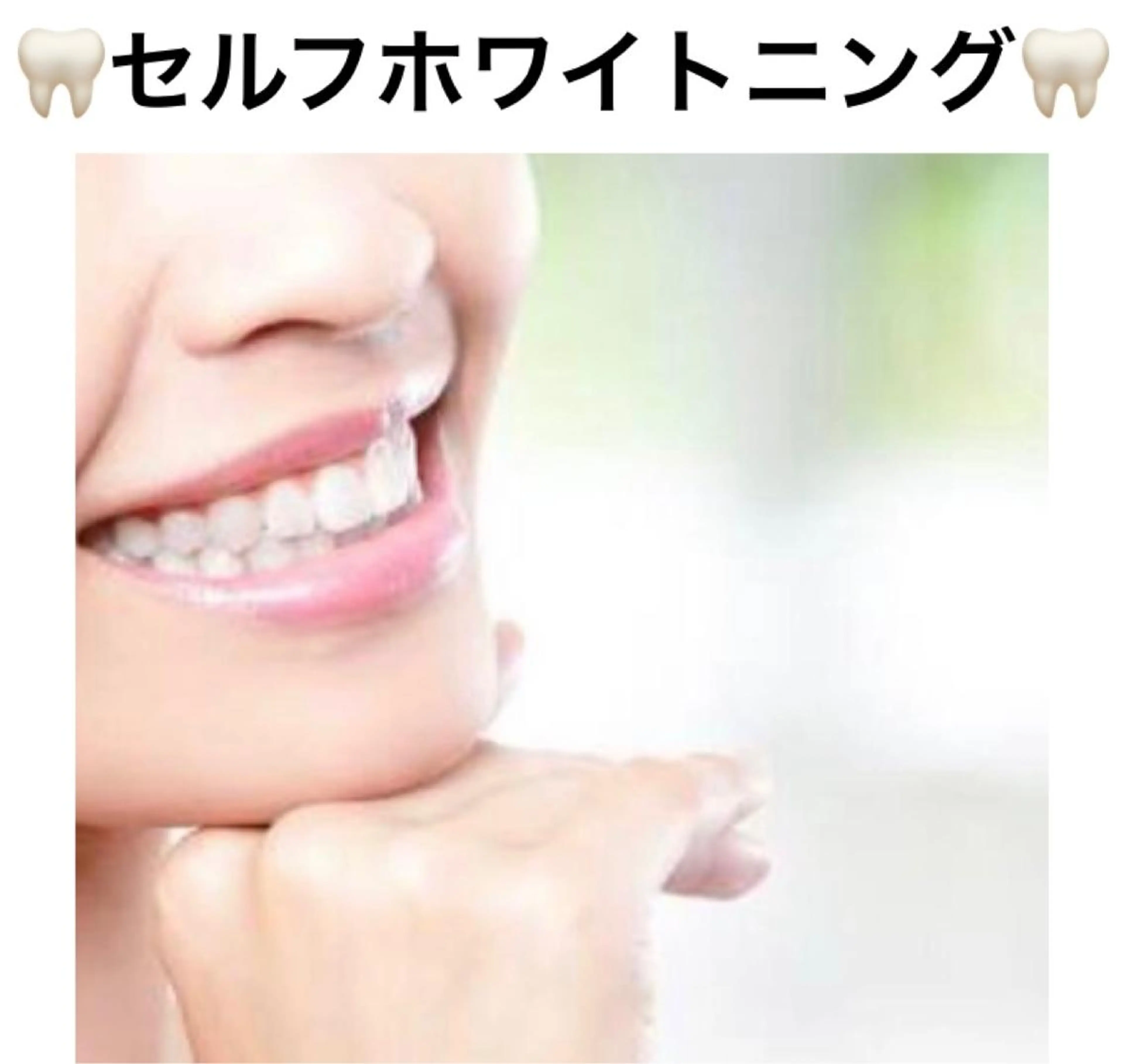 【学割】セルフホワイトニング10分照射✖️2回が3回分26400円➡️9350円❣️就活、イベント🦷初回より2ヶ月有効の写真