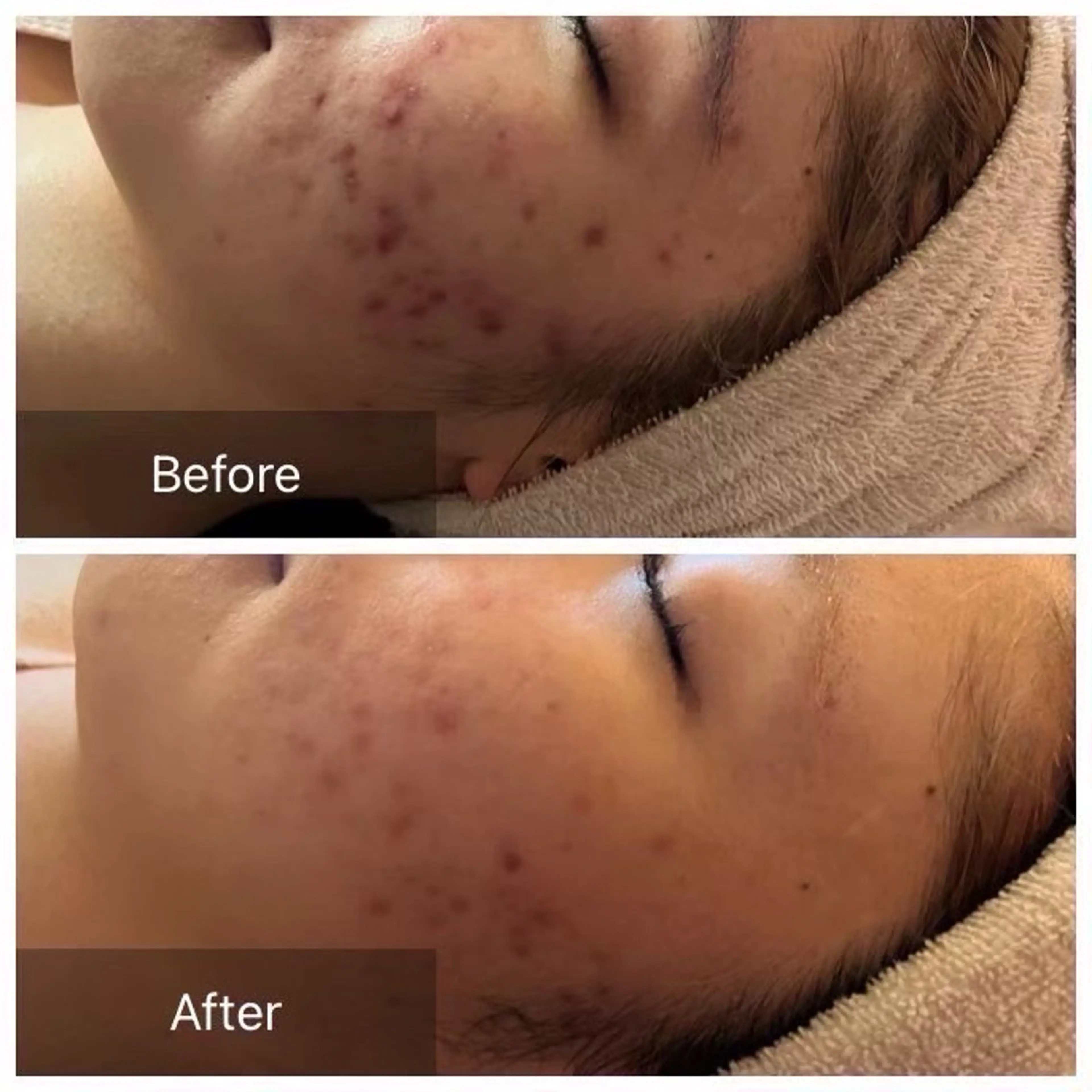 六本木脱毛andS さおりのエステ・リラクイメージ