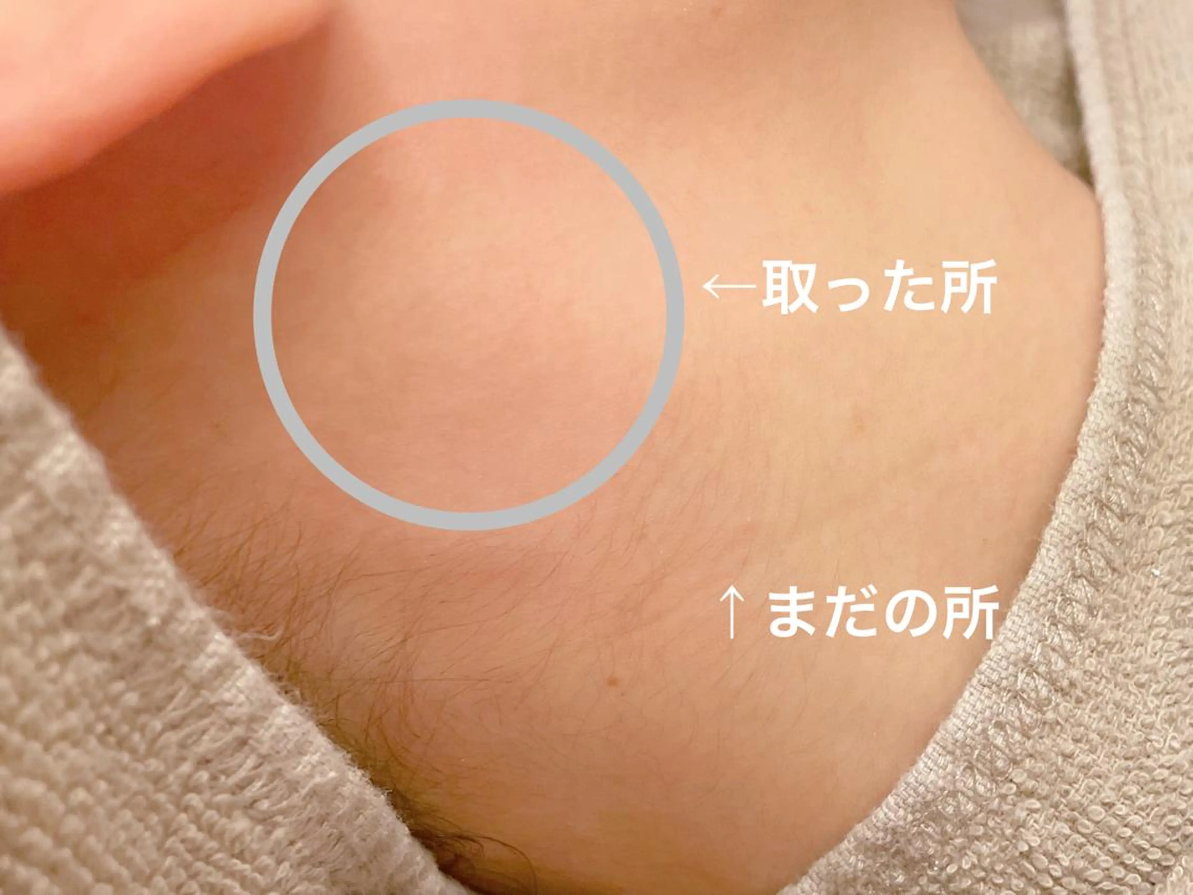 脱毛 リップル 心斎橋 ripplu心斎橋のマツエク・マツパデザイン