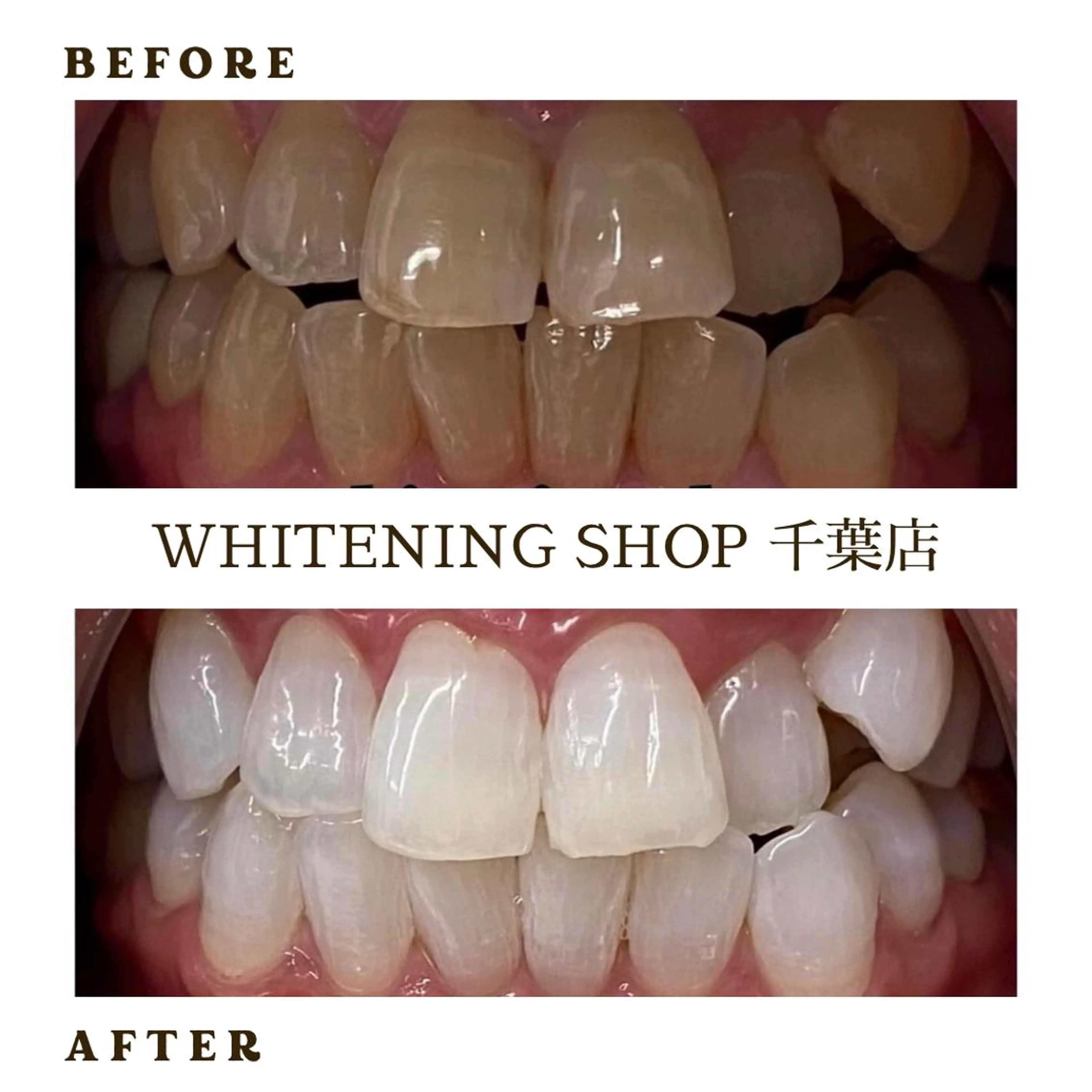 メンズ エステ ホワイトニング ショップ千葉店のその他イメージ