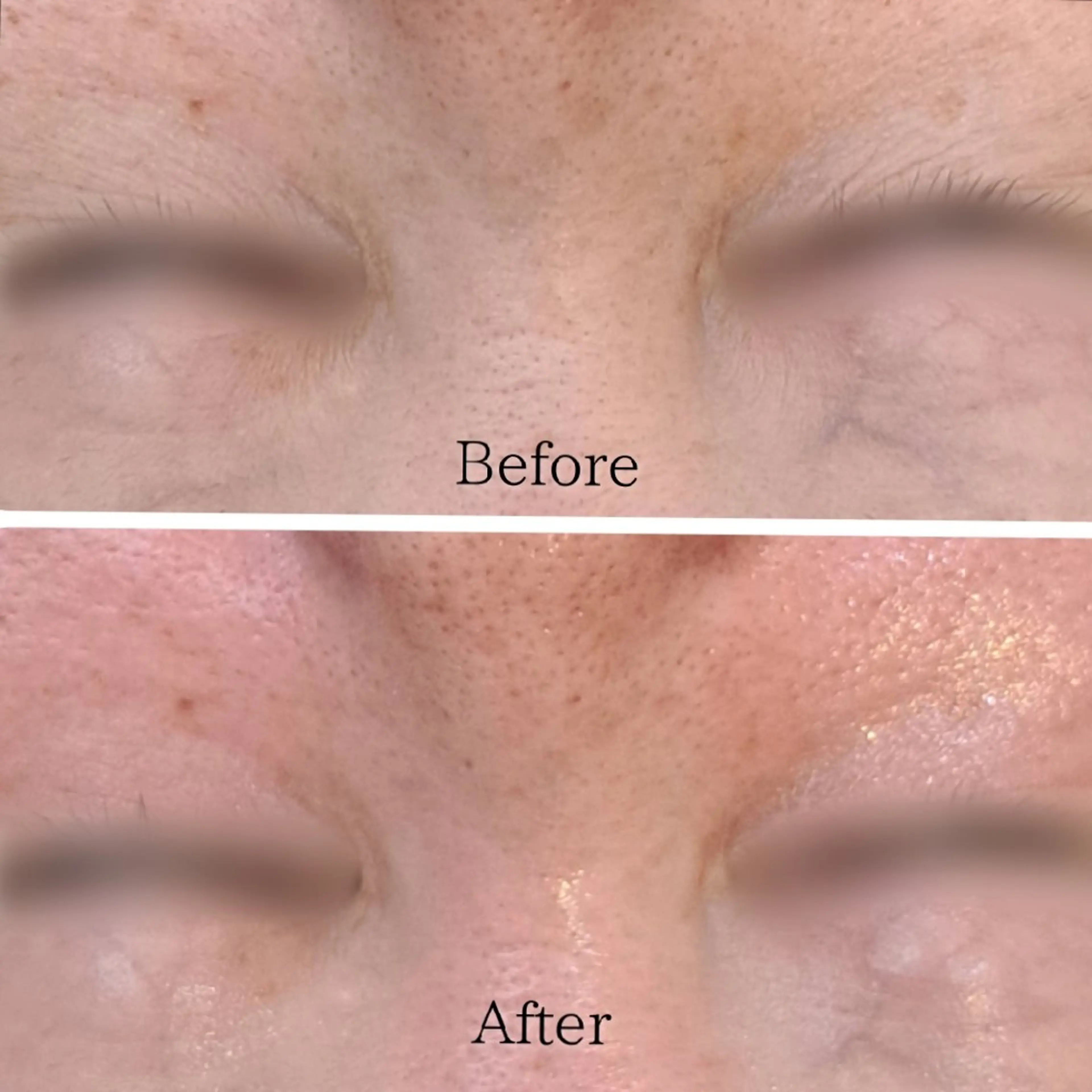 Hisui 種村のエステ・リラクイメージ